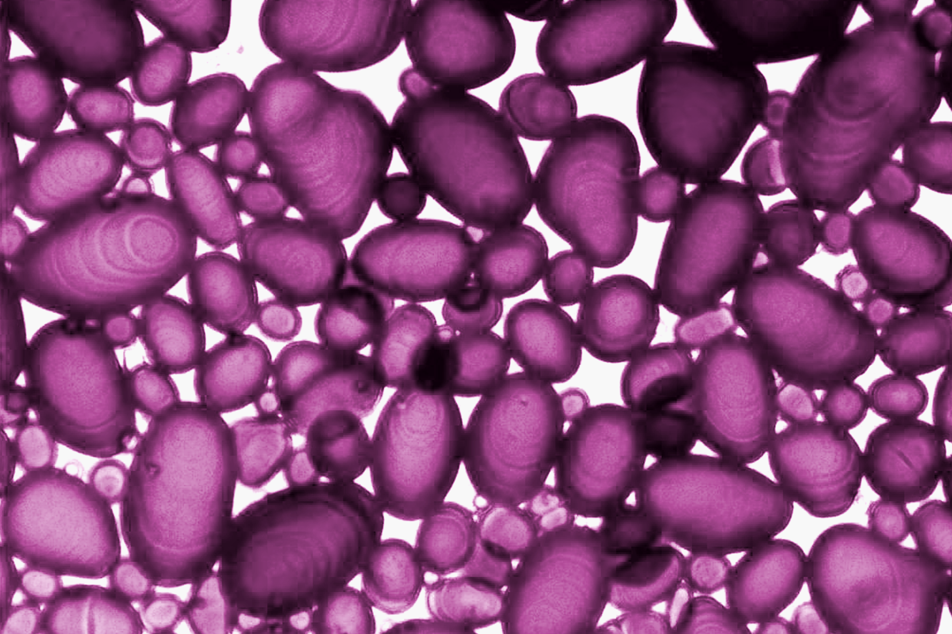Ilustracja przedstawia zabarwione na fioletowo ziarna skrobi w bulwie ziemniaka. Są to owalne struktury o różnym rozmiarze.