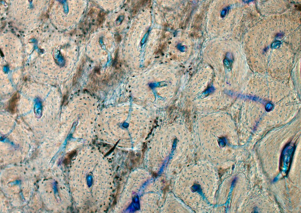 Ilustracja przedstawia komórki o kształcie zbliżonym do kół. W ich środku są wybarwione na niebiesko kropki. Od niektórych odchodzą niebieskie naczynia.  