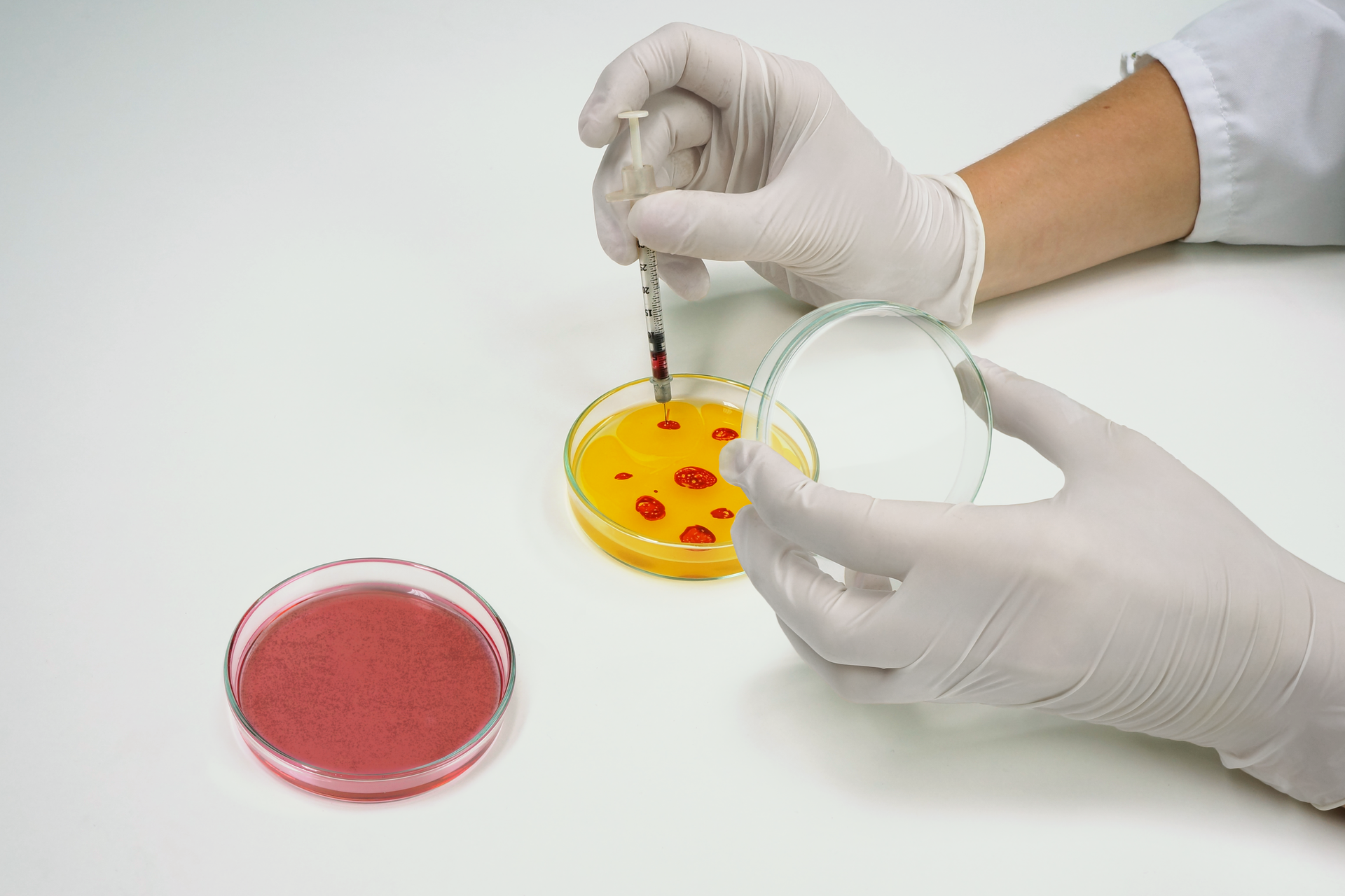 Zdjęcie przedstawia przykład inżynierii genetycznej. Laborant nakłada próbki na szalkę Petriego. Próbki są czerwone, a pożywka w szalce żółta. Widać dłonie laboranta, ma ubrane rękawiczki.
