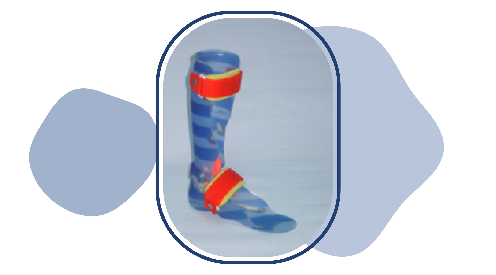 Zdjęcie przedstawia ortezę mającą formę płaskiej podeszwy i przedłużenie wzdłuż kości piszczelowej do stawu kolanowego użytkownika. Orteza poszerza się od śródstopia i stopniowo okala kończynę. Aparat ortopedyczny ma dwa rzepy wypadające w miejscu stawu skokowego i pod stawem kolanowym pacjenta.