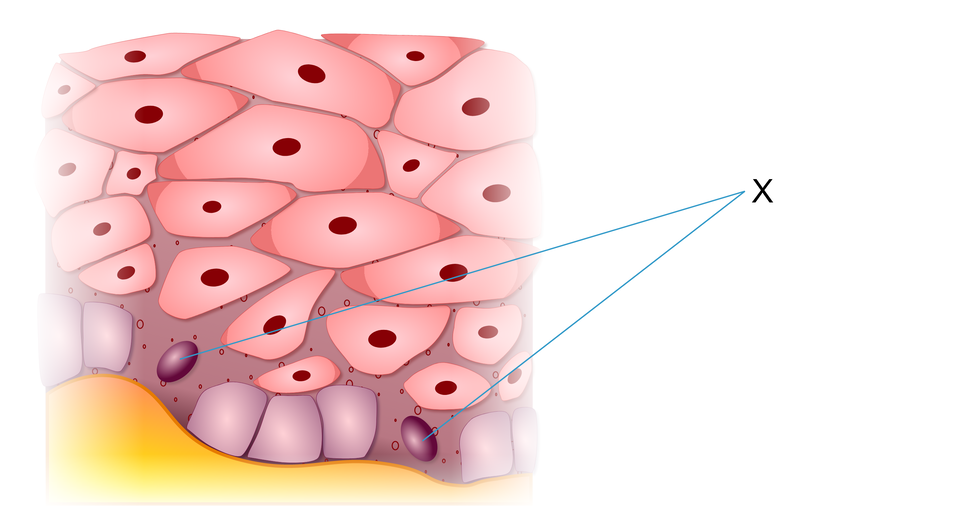 Ilustracja przedstawia warstwę zbudowaną z jasnoróżowych komórek. Blisko warstwy skóry właściwej pod różowymi, walcowatymi komórkami, są elementy z wypustkami. Mają ciemnofioletowe zabarwienie.   