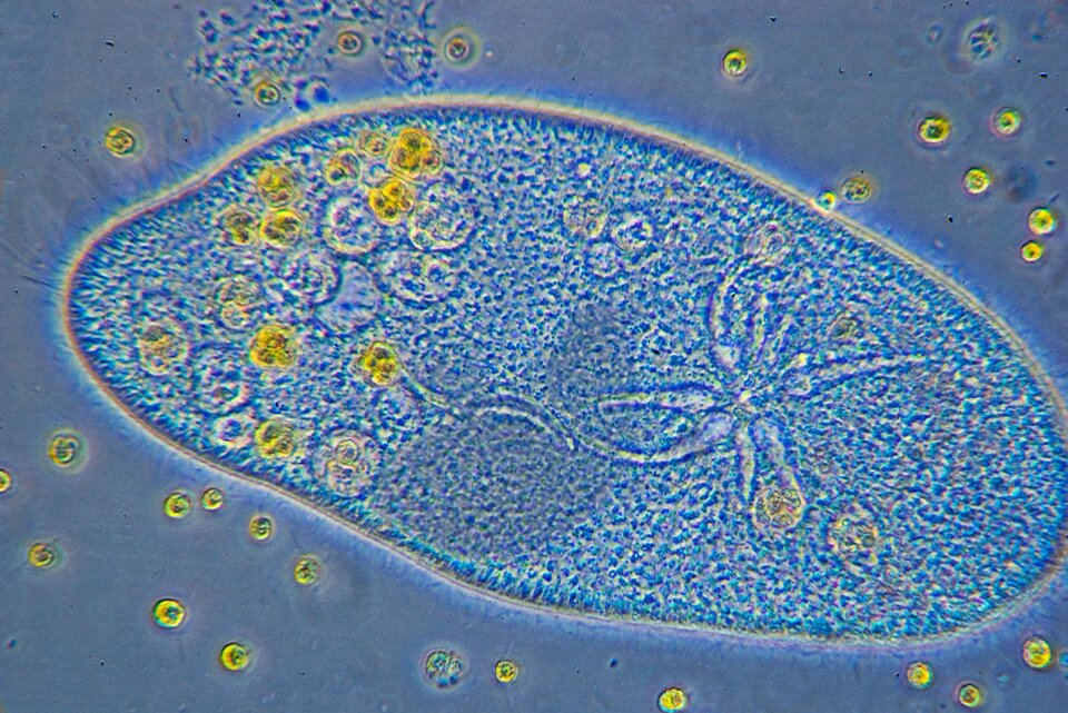 Zdjęcie spod mikroskopu kontrastowo‑fazowego w powiększeniu czterdziestokrotnym przedstawia pantofelka. Pantofelek ma wydłużone ciało o charakterystycznym kształcie buta, z zewnątrz pokryte jest rzędami rzęsek. Otacza je żywa osłona. W środku znajdują się żółte, nieregularnie ułożone, okrągłe struktury. Widoczna jest również wodniczka tętniąca w kształcie słońca z odchodzącymi od centrum odnogami. 
