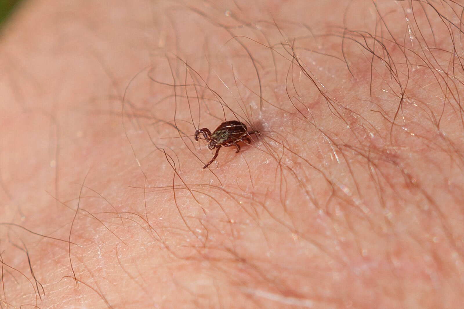 Fotografia przedstawiająca zbliżenie na kleszcza znajdującego się na skórze między włosami.