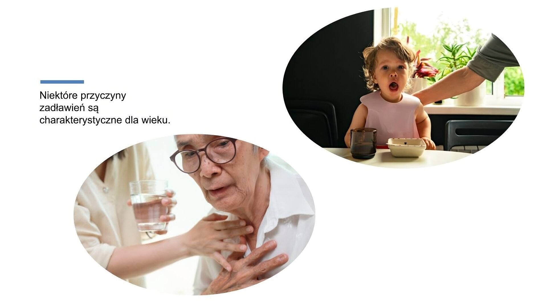 Biały slajd. W lewym górnym rogu tekst: „Niektóre przyczyny zadławień są charakterystyczne dla wieku”. Poniżej zdjęcie starszego mężczyzny w białej koszuli i okularach w ciemnych oprawkach. Przykłada on dłoń do klatki piersiowej. Obok niego stoi kobieta w jasnej bluzce, która przykłada prawą dłoń do gardła mężczyzny. W drugiej ręce trzyma szklankę z wodą. W prawym górnym rogu slajdu drugie zdjęcie, które przedstawia małe dziecko, które otwiera usta. Siedzi przy stole, na którym stoi kubek oraz miseczka. Za plecami dziecka znajduje się dłoń dorosłego.