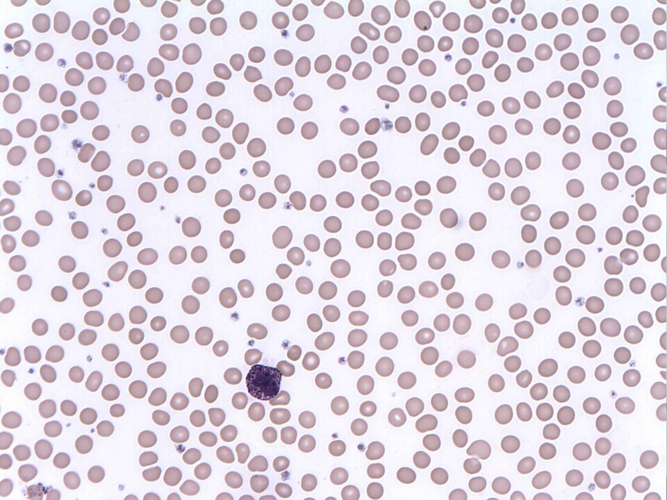 Na fotografii z mikroskopu świetlnego w powiększeniu stukrotnym znajdują się bazofile, czyli leukocyty, których cytozol wypełniony jest ziarnistościami barwiącymi się na kolor niebieski. Mają kulisty kształt i wydłużone, segmentowane jądro z dwoma lub więcej przewężeniami. Średnica bazofilów osiąga wielkość ok. 10 μm. 