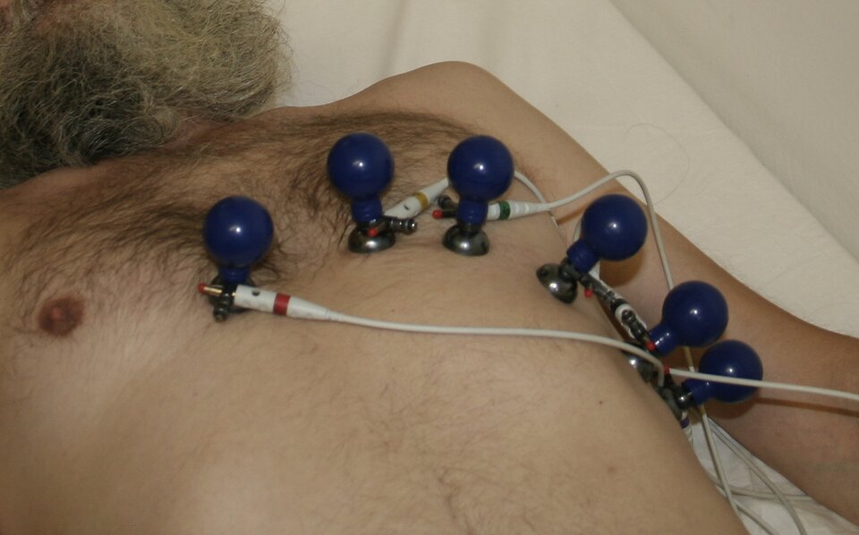 Grafika przedstawia pacjenta podczas badania EKG. Mężczyzna leży na plecach, a do jego nagiej klatki piersiowej w pewnych odstępach przyczepione są błękitne bańki połączone z kablami. 