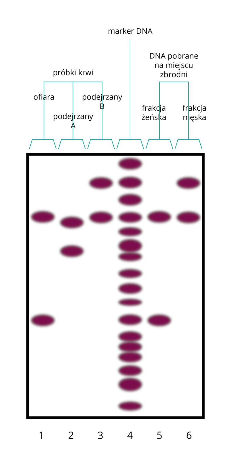Schemat identyfikacji gwałciciela na podstawie danych genetycznych. Grafika przedstawia porównanie próbek DNA poddanych elektroforezie. Widoczne jest sześć kolumn, w których na różnych wysokościach rozmieszczone są fioletowe prązki. Pierwsza kolumna to DNA pobrane z próbki krwi ofiary, druga – z próbki krwi podejrzanego A, trzecia – z próbki krwi podejrzanego B. W czwartej kolumnie znajduje się marker DNA, zaznaczono w niej wszystkie możliwe do uzyskania prążki. W kolumnach piątej i szóstej umieszczono DNA pobrane na miejscu zbrodni, w piątej kolumnie frakcję żeńską, a w szóstej frakcję męską. Rozłożenie prążków jest takie same w kolumnie trzeciej (próbka krwi podejrzanego B) oraz w kolumnie szóstej (frakcja męska DNA pobranego na miejscu zbrodni), przez co, cechy DNA podejrzanego B są zgodne z drugą próbką krwi pobraną na miejscu przestępstwa.