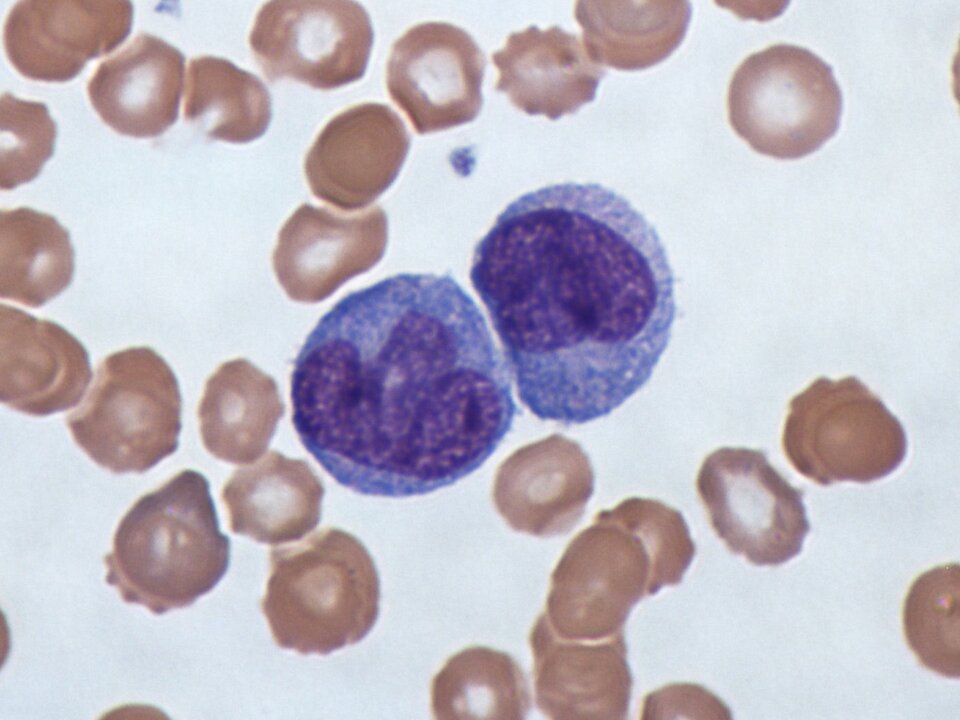 Na fotografii z mikroskopu świetlnego w powiększeniu tysiąckrotnym widoczne monocyty - największe krwinki spośród leukocytów o średnicy dochodzącej do 20 μm. Są fioletowe, półprzezroczyste, z ciemnofioletowym kształtem w środku. 