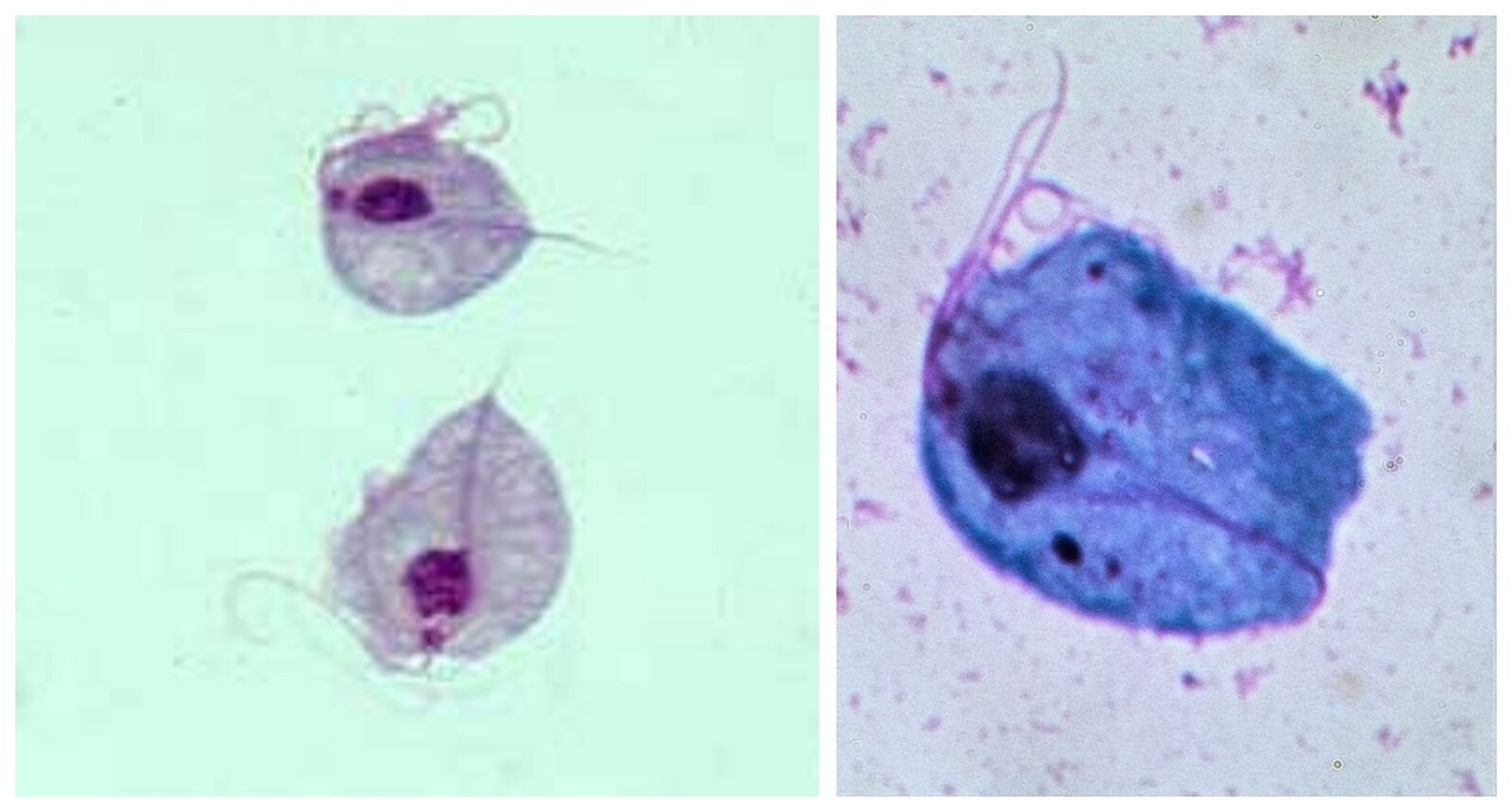 Fotografia przedstawia rzęsistka pochwowego. Po lewej stronie na zielonym tle widoczne są dwa jasno‑fioletowe jednokomórkowce o eliptycznym kształcie. Po prawej stronie znajduje się przybliżenie na jednokomórkowca o ciemnoniebieskim kolorze i kształcie przypominającym prostokąt.