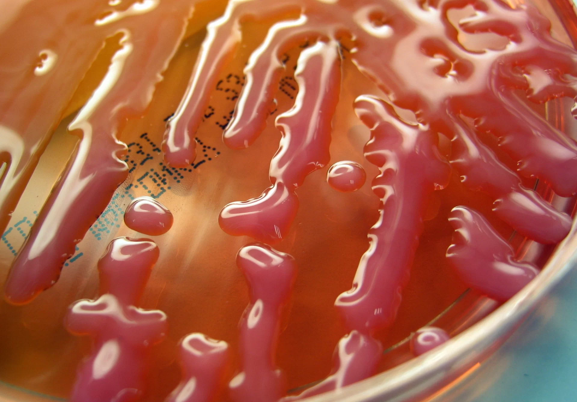 Zdjęcie szalki Petriego pokrytej pałeczkami zapalenia płuc Klebsiella pneumoniae. Pałeczki tworzą na szalce liczne kolonie o podłużnym kształcie i śluzowatym wyglądzie.