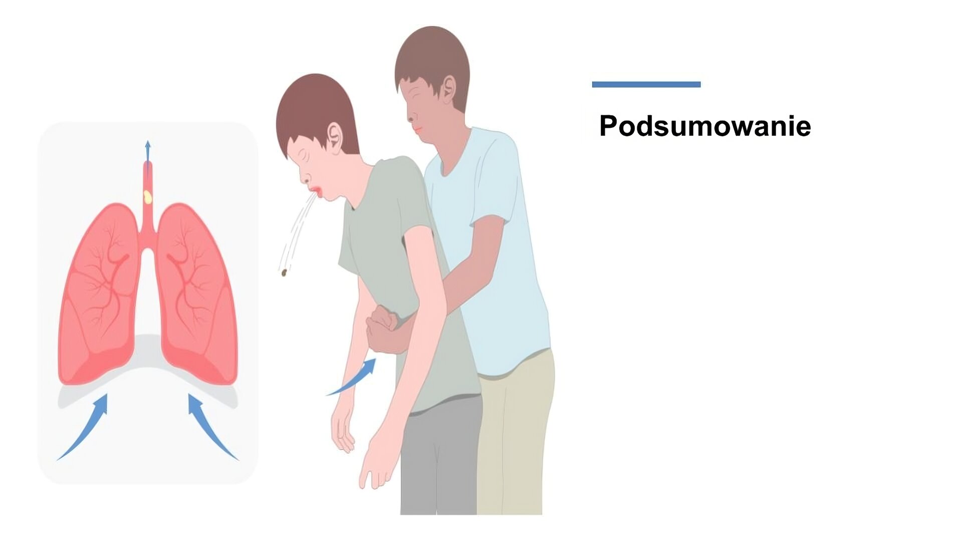 Biały slajd. Z lewej strony dwie ilustracje ustawione jedna obok drugiej. Ilustracja z lewej strony przedstawia płuca oraz jasny element w tchawicy. Pod płucami niebieskie strzałki skierowane ku górze. Obok druga ilustracja przedstawiająca dwóch młodych chłopców stojących jeden za drugim. Pierwszy z nich wypluwa mały element z buzi. Stojący za nim chłopiec obejmuje go w pasie. Przy jego dłoniach niebieska strzałka wskazująca na wykonywany przez ratownika gest. W prawym górnym rogu slajdu napis: „Podsumowanie”.
