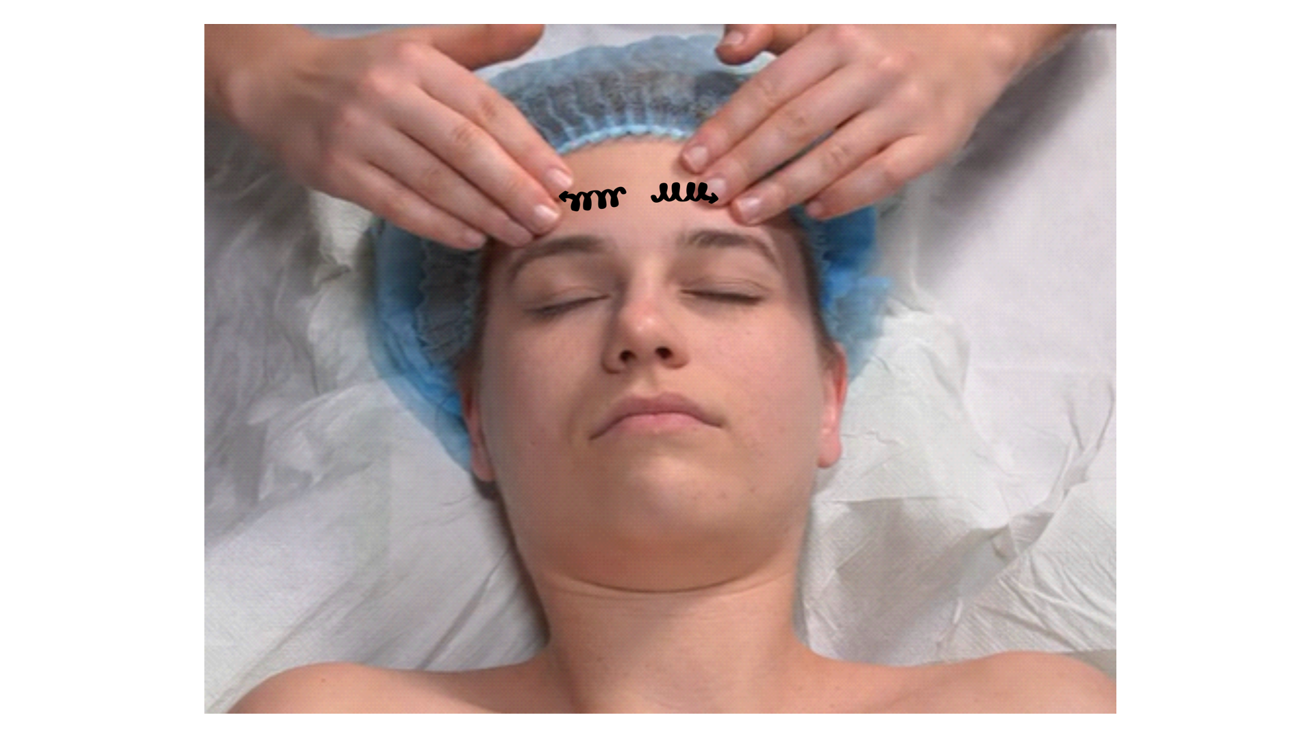 Zdjęcie przedstawia twarz pacjenta w leżeniu tyłem. Głowa pacjenta spoczywa na poduszce. Masażysta znajduje się za głową pacjenta i wykonuje opuszkami palca wskazującego i długiego ruch rozcierania pod oczami rozpoczynając od  okolicy wewnętrznych kącików  oczu, kierując się następnie w stronę małżowin usznych. 