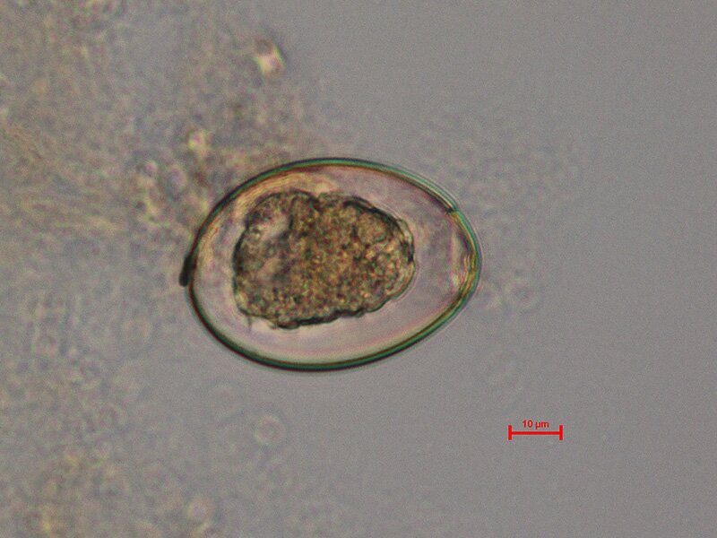 Zdjęcie przedstawia mikroskopowe powiększenie jaja bruzdogłowca. Ma owalny kształt, po środku jest ciemnozielony fragment, wokół którego obszar jest przezroczysty. Na dole jest ukazana skala przedstawiająca dziesięć mikrometrów, która jest o wiele mniejsza od jaja.