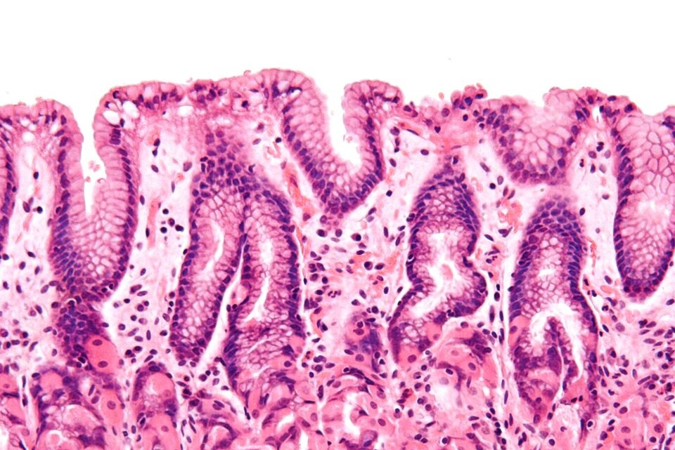 Ilustracja przedstawia model nabłonka jednowarstwowego walcowatego. Na modelu pokazano tkankę łączną, komórki kielichowate, błonę podstawną, jajowate komórki nabłonkowe z jądrami w centrum oraz rzęskami na powierzchni wolnej. Z prawej fragment obrazu mikroskopowego ujęty z góry. Komórki ustawione są pionowo koło siebie jednak koło drugiej. W środku znajdują się jądra komórkowe.