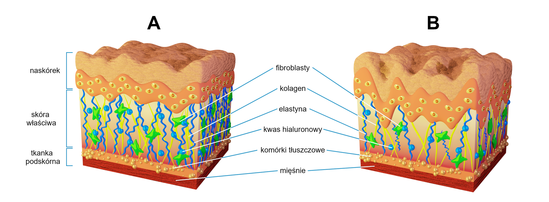 Dwie ilustracje obok siebie oznaczone jako A i B. Na ilustracjach zaznaczono warstwy naskórka, skóry właściwej oraz tkanki podskórnej. W skórze właściwej zaznaczono fibroblasty, kolagen, elastynę, kwas hialuronowy, komórki tłuszczowe, warstwę mięśni. Porównując ilustrację A do B na ilustracji A jest więcej fibroblastów, włókien kolagenowych łączących tkankę zbudowaną z komórek tłuszczowych z dolną warstwą naskórka. Na ilustracji A jest również dużo więcej – w porównaniu do ilustracji B - kwasu hialuronowego (mają postać niebieskich kulek) oraz elastyny (ma postać falistych włókien, które łączą tkankę podskórną z dolną warstwą naskórka, podobnie jak proste włókna kolagenowe). Kwas hialuronowy przyczepia się do włókien elastyny.  