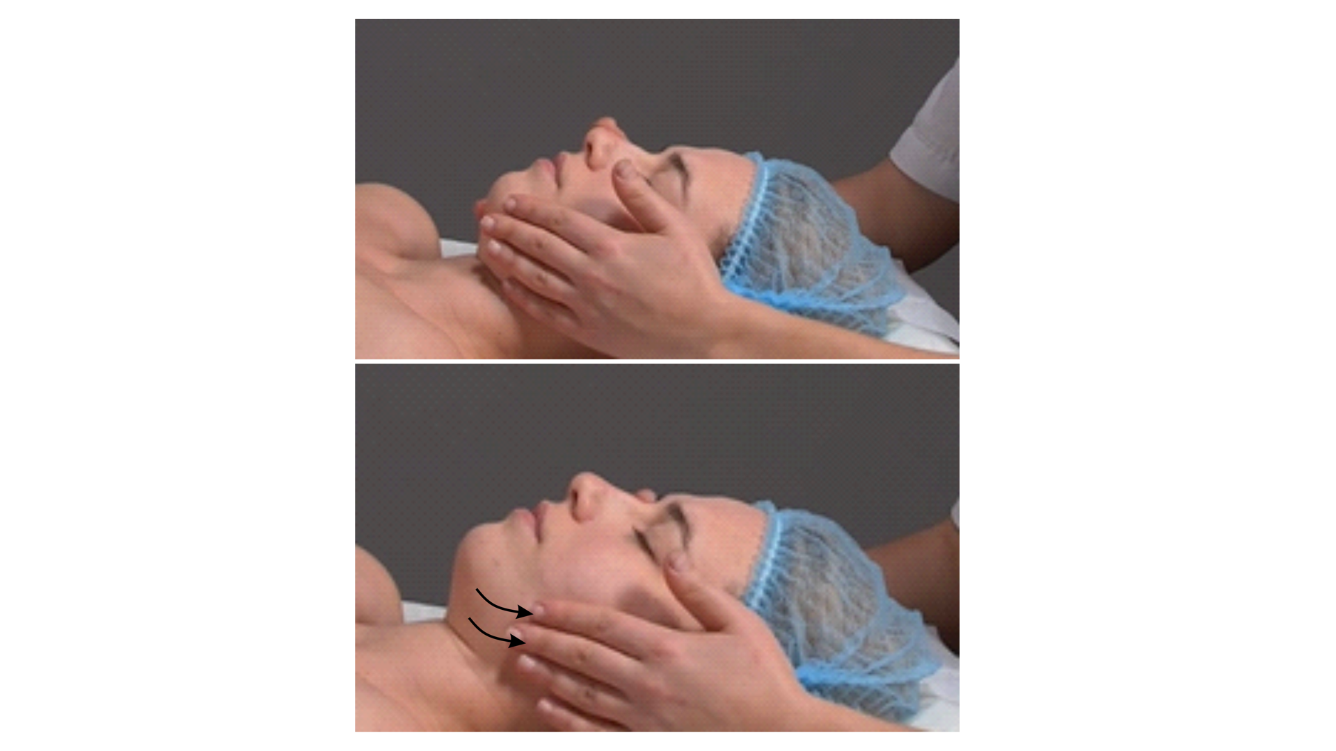 Zdjęcie przedstawia twarz pacjenta w leżeniu tyłem. Głowa pacjenta spoczywa na poduszce. Masażysta znajduje się za głową pacjenta i wykonuje opuszkami palców obu rąk ruch głaskania policzków rozpoczynając od brody w kierunku małżowin usznych. 