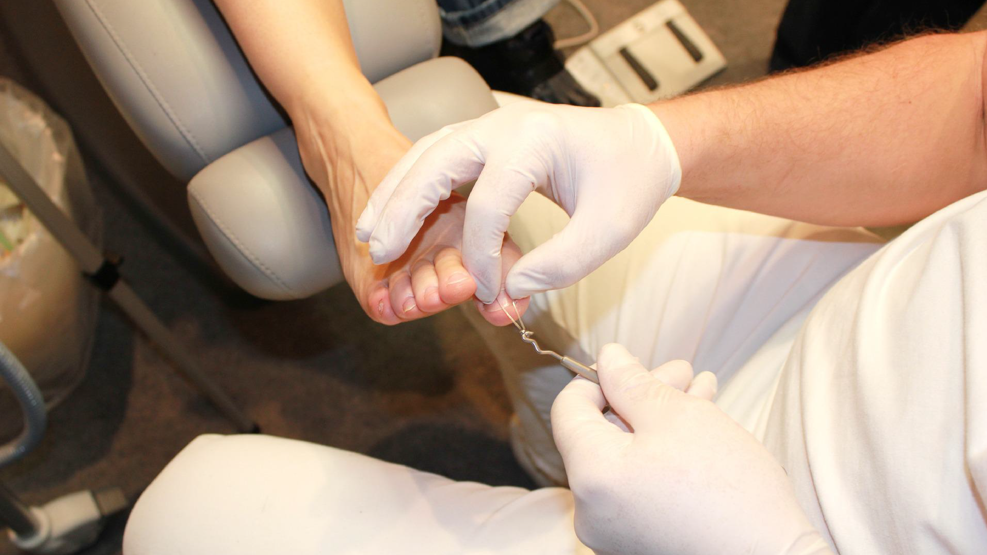 Zdjęcie przedstawia lekarza, który leczy stopy. Na zdjęciu widoczne są ręce lekarza w gumowych rękawiczkach. Lekarz bada stopę pacjentki.