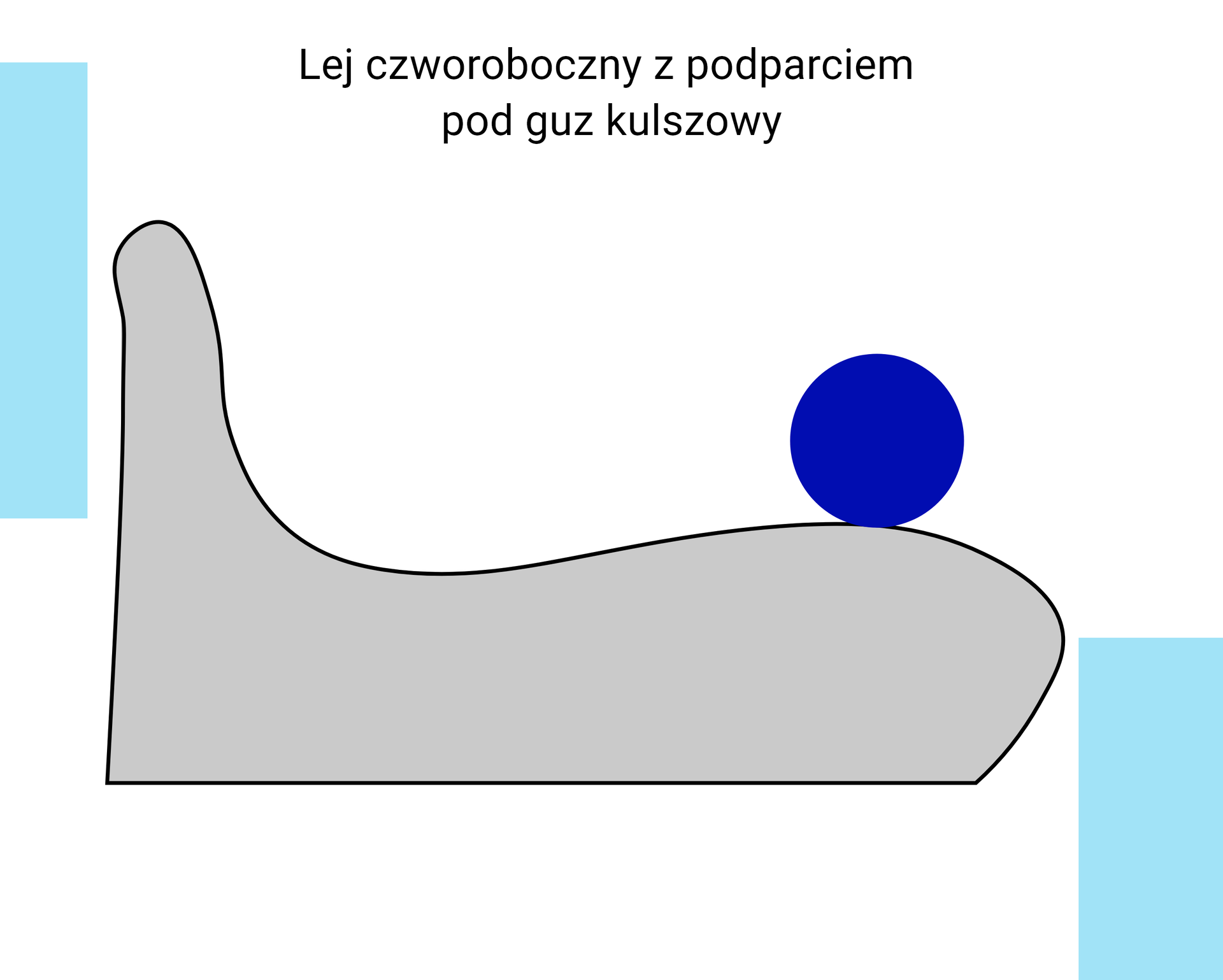 Schemat graficzny przedstawiający przekrój czołowy leja czworobocznego z podparciem pod guz kulszowy.
