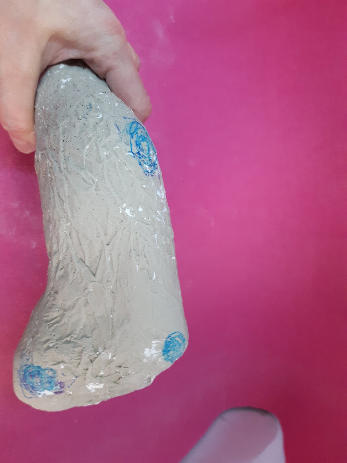 Zdjęcie przedstawia odlew gipsowy stopy z zaznaczonymi bolesnymi miejscami. 