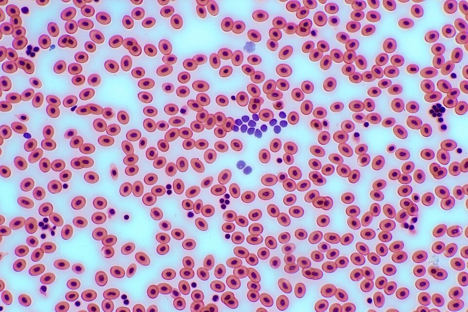 Ilustracja przedstawia wiele komórek o okrągłym kształcie w różowym kolorze. Część z nich jest ze sobą połączona, tworząc łańcuszki. Na ilustracji widać skupiska mniejszych fioletowych komórek. 