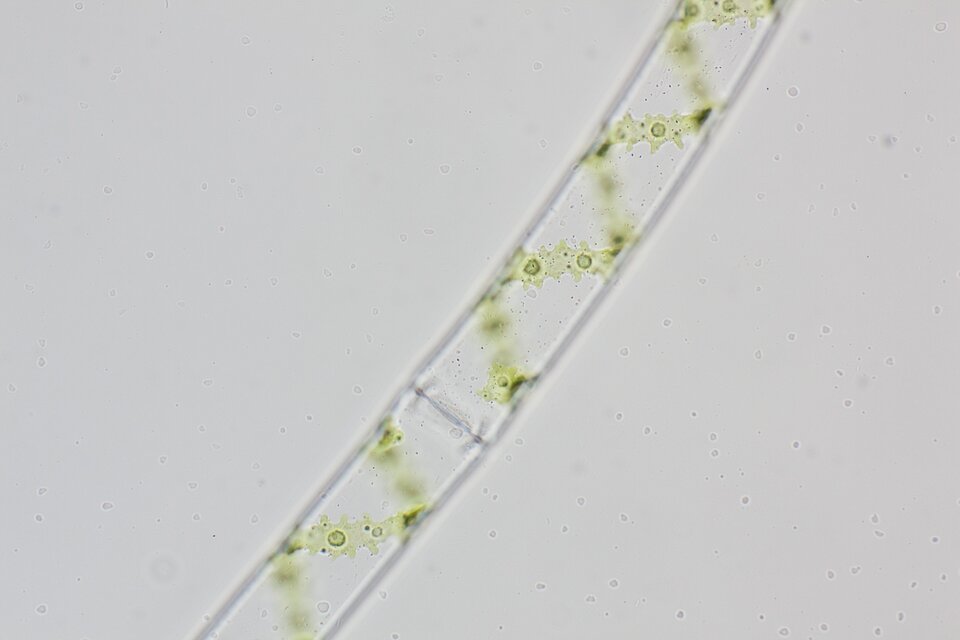 Zdjęcie spod mikroskopu świetlnego z zastosowaniem metody jasnego pola w powiększeniu czterdziestokrotnym przedstawia zielenicę o nazwie skrętnica. Na zdjęciu znajduje się przezroczysty przewód podzielony na segmenty, a wzdłuż całego przekroju przewodu widoczna jest spiralnie ułożona, zielona struktura. Przewód znajduje się na jasnoszarym tle. 