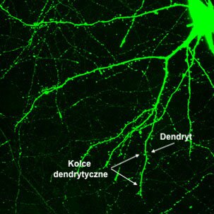 Zdjęcie przedstawia komórkę nerwową w przybliżeniu. Na końcach dendrytów można zauważyć małe, osro zakończone kolce dendryczne.