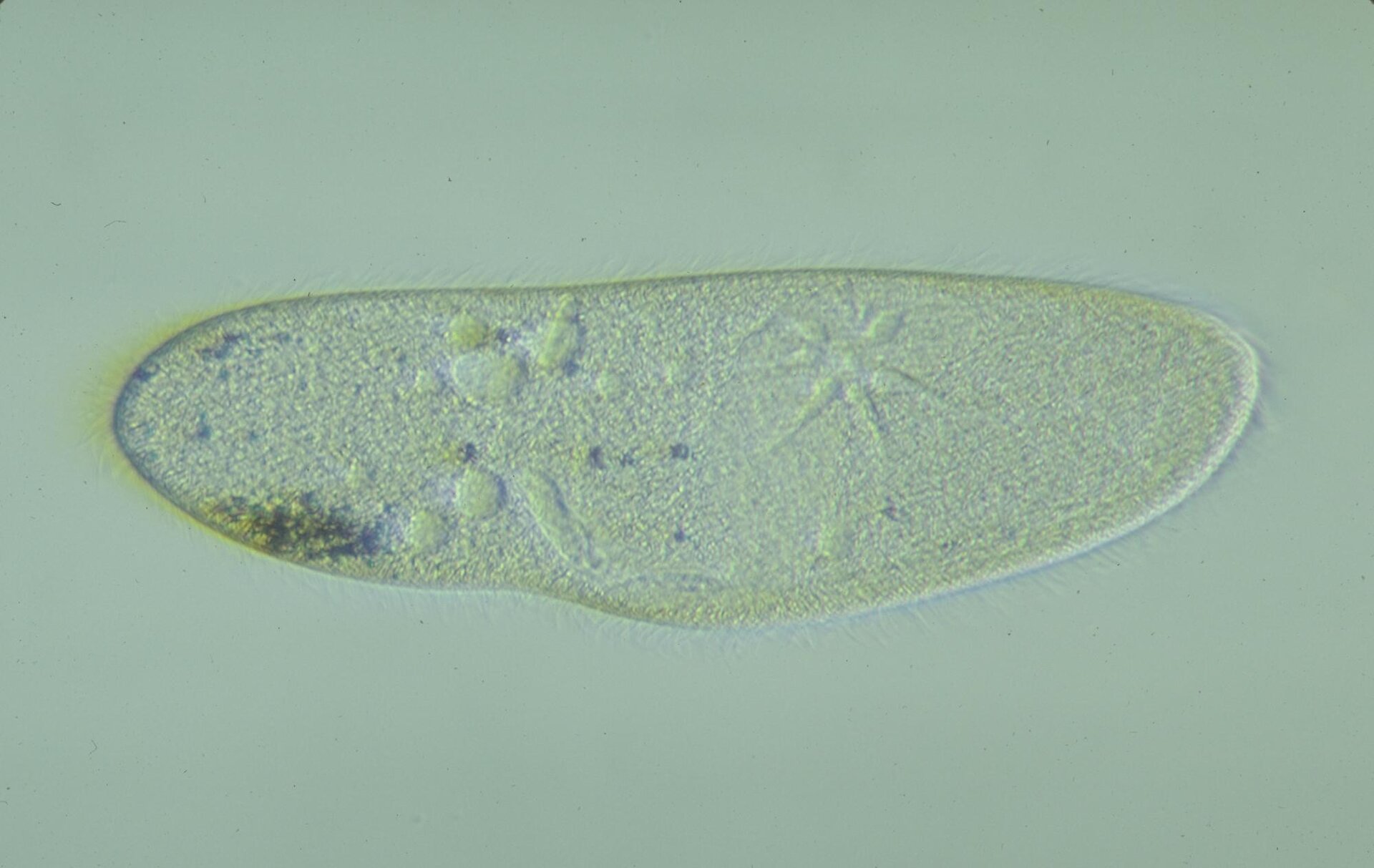 Zdjęcie przedstawia pantofelka. Jest to organizm jednokomórkowy o kształcie podeszwy buta. Jest półprzezroczysty. Od ściany komórkowej na zewnątrz komórki wystają drobne rzęski. W środku komórki widoczne są różne struktury. W cytoplazmie widoczne są wodniczki. Wodniczki przedstawione są jako okrągłe struktury, od których promieniście odchodzą podłużne elementy.