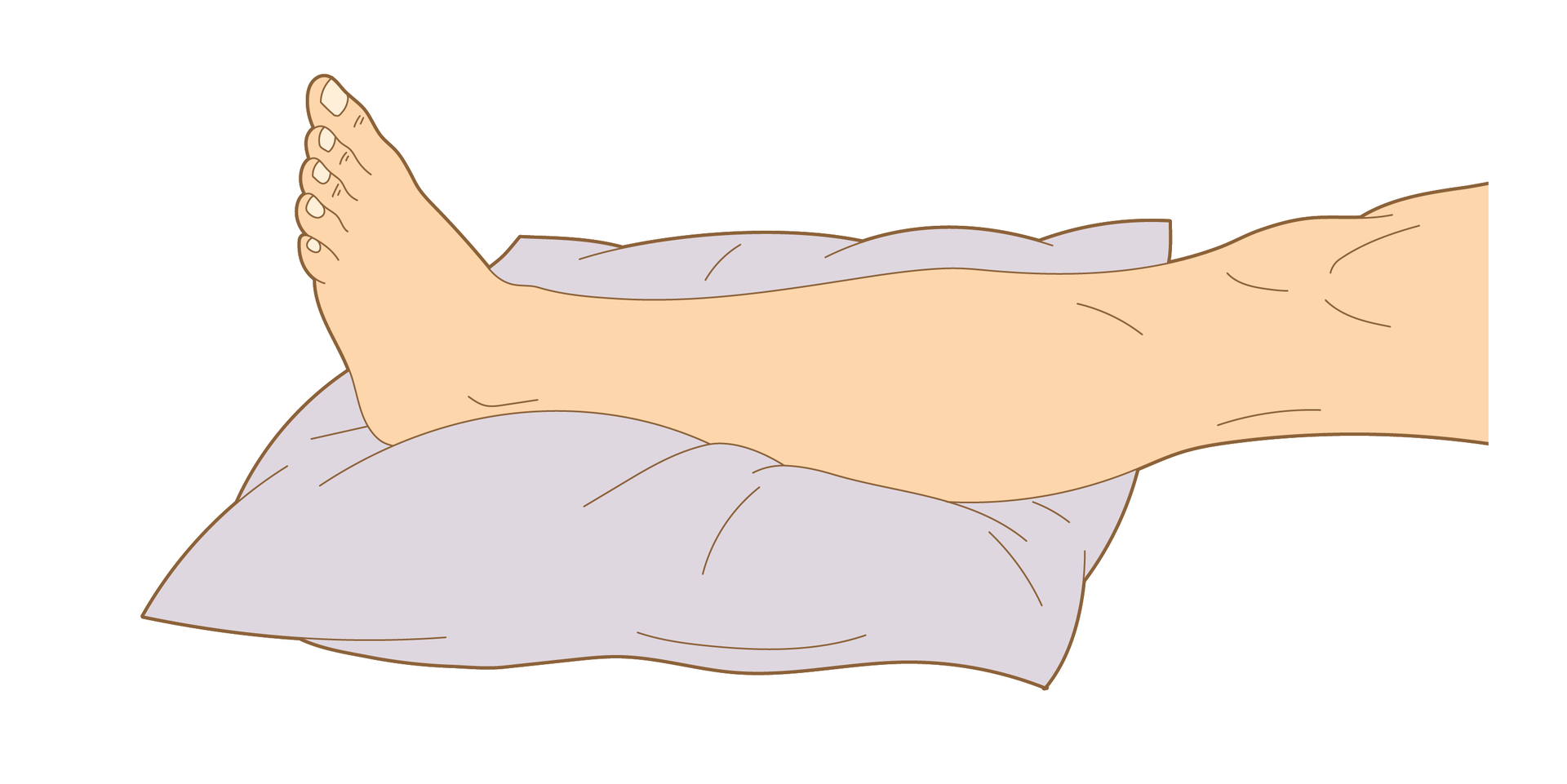 Rysunek czwarty przedstawia pierwszy etap unieruchamiania jednej nogi za pomocą koca. Na ilustracji lewa noga bez odzieży pokazana od kolana w dół skierowana stopą w lewą stronę. Ułożona poziomo i wsparta stopą i łydką na dużej i płaskiej poduszce.