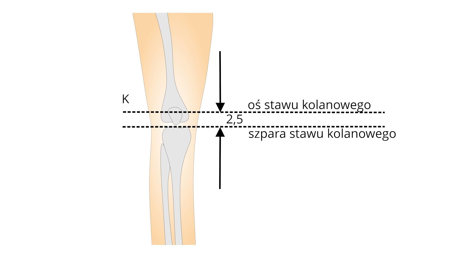 Rycina przedstawia schemat budowy kostnej stawu kolanowego od przodu. Literą K oznaczona jest pozioma linia osi stawu kolanowego. Pod linią znajduje się równoległa linia podpisana: szpara stawu kolanowego. Odległość pomiędzy punktami wynosi 2,5 centymetra.