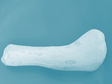 Zdjęcie przedstawia odlew gipsowy stopy gotowy do przygotowania wkładki.