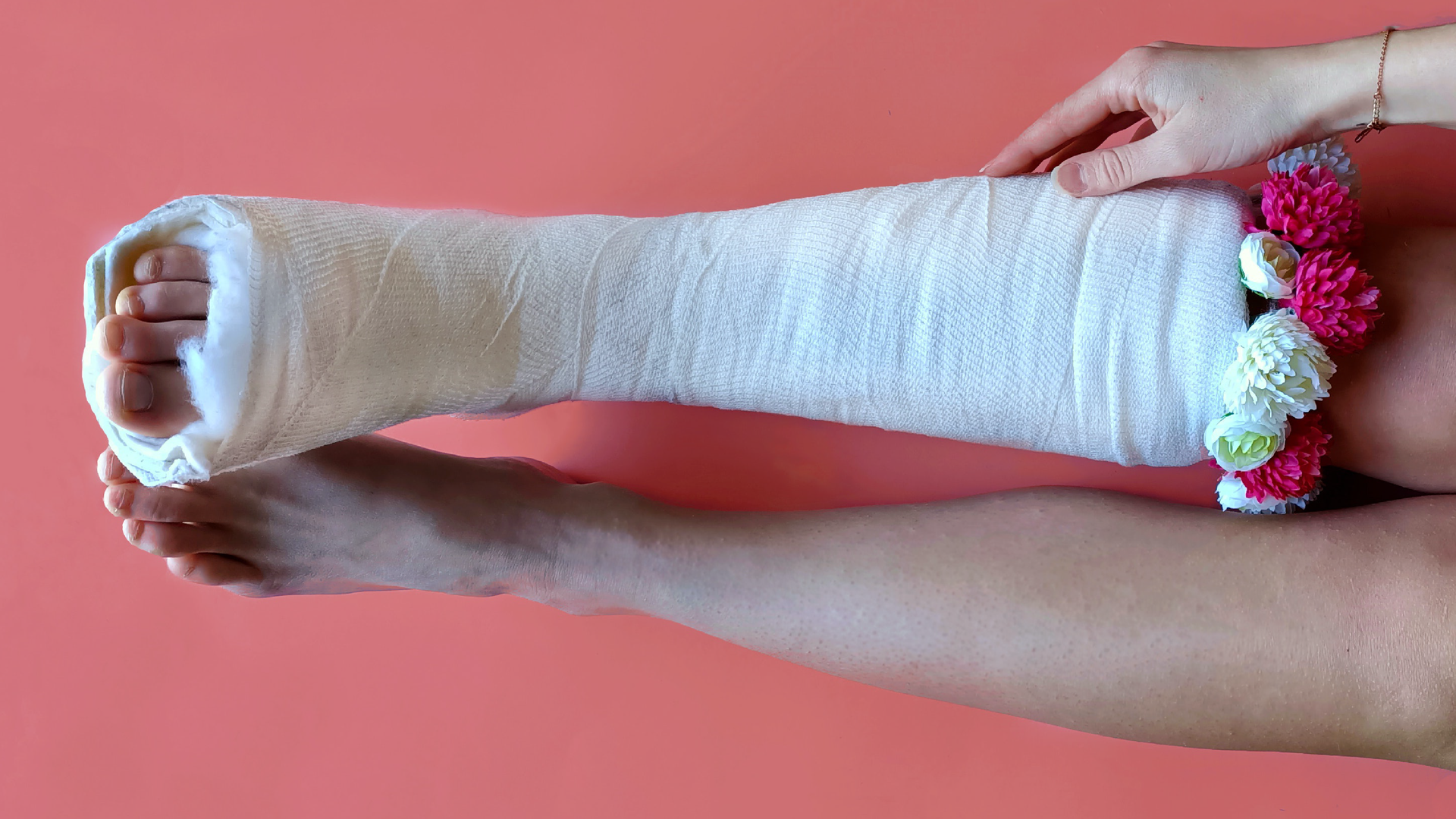 Zdjęcie przedstawia nogi osoby. Prawa noga jest w gipsie.