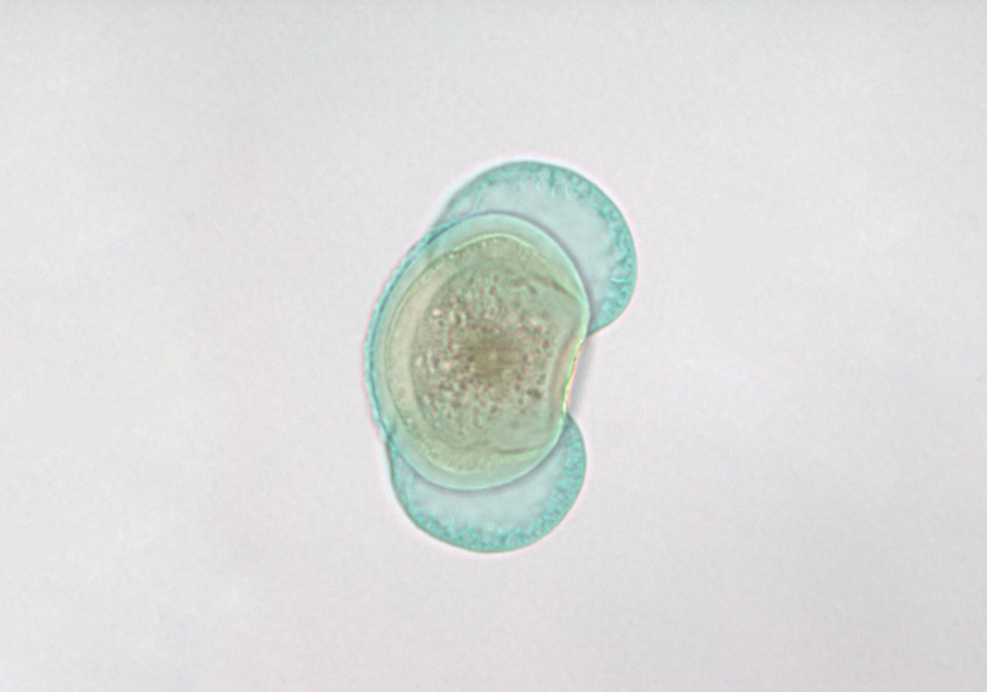 Na zdjęciu ziarno pyłku (mikrospora) sosny w dużym powiększeniu. Pośrodku ziarno właściwe w owalnym kształcie, z którym połączone są dwa puste w środku worki powietrzne, umożliwiające przenoszenie się ziarna na dalsze odległości. 