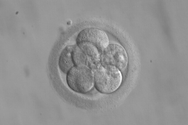 Zdjęcie przedstawia morulę w powiększeniu mikroskopowym. W jej budowie możemy wyróżnić osłonkę przejrzystą, która otacza kilka mniejszych, kulistych komórek.  