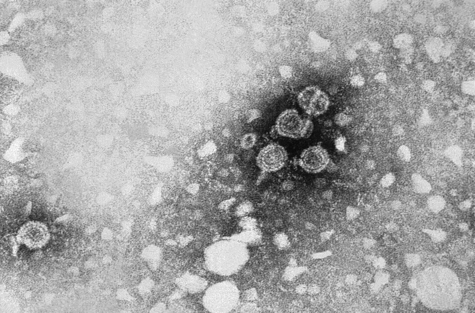 Zdjęcie mikroskopowe przedstawia budowę wirusa HBV o nieregularnym kształcie. Wewnątrz otoczki wirusa znajduje się DNA. Ten groźby wirus prowadzący do zapalenia wątroby jest pokryty przez drobne przypominające białe punkty struktury.