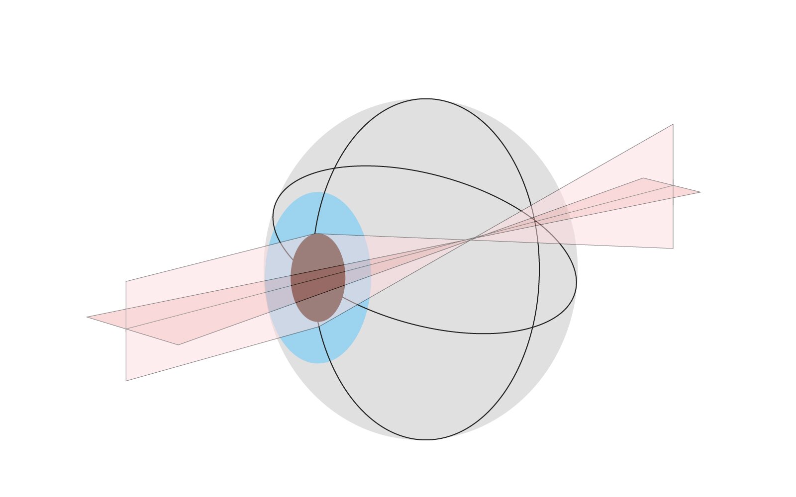 Ilustracja przedstawia astygmatyzm. Jest to zaburzenie symetrii obrotowej gałki ocznej, które powoduje powstanie na siatkówce obrazu nie punktowego. Odczuwamy to jako krzywienie obrazu, pogarszanie ostrości i czułości na kontrast.