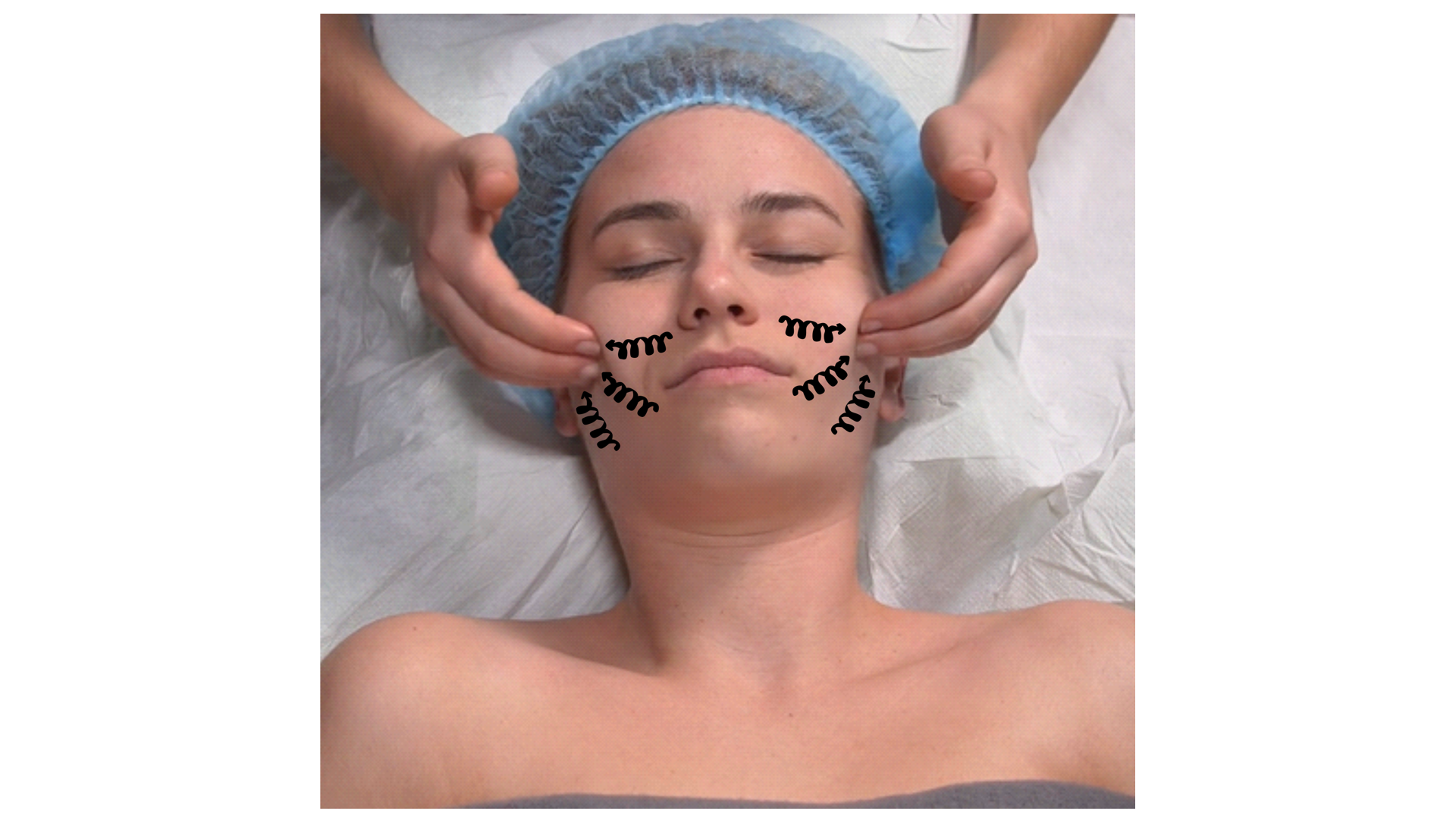 Zdjęcie przedstawia twarz pacjenta w leżeniu tyłem. Głowa pacjenta spoczywa na poduszce. Masażysta znajduje się za głową pacjenta i wykonuje opuszkami palców obu rąk ruch rozcierania policzków rozpoczynając od brody w kierunku małżowin usznych. 