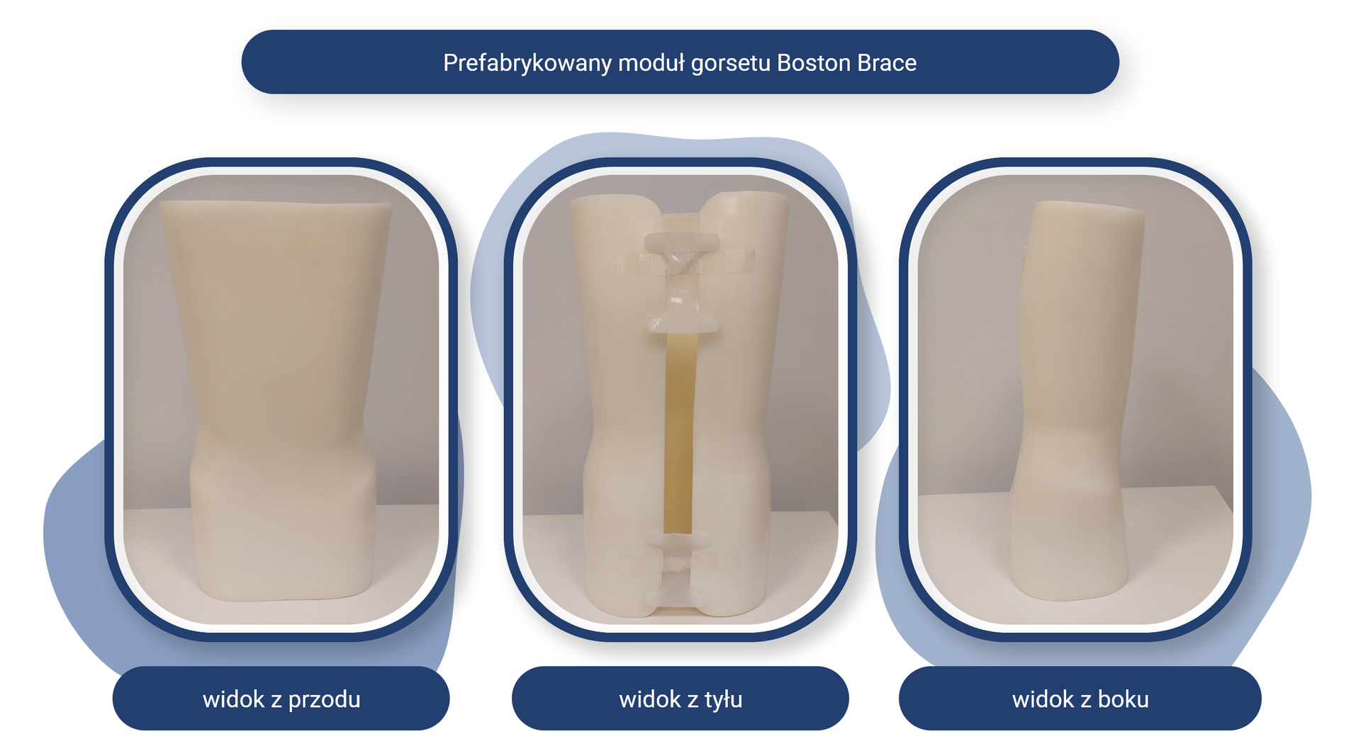 Plansza pod tytułem: Prefabrykowany moduł gorsetu Boston Brace. Plansza zawiera trzy zdjęcia z podpisami.
Zdjęcie opisane jako widok z przodu przedstawia zabudowany gorset z profilowanym odcinkiem biodrowym.
Zdjęcie opisane jako widok z tyłu przedstawia zabudowany gorset z profilowanym odcinkiem biodrowym i umożliwiającym zakładanie gorsetu rozcięciem na całej długości. 
Zdjęcie opisane jako widok z boku przedstawia zabudowany gorset z profilowanym odcinkiem biodrowym.
