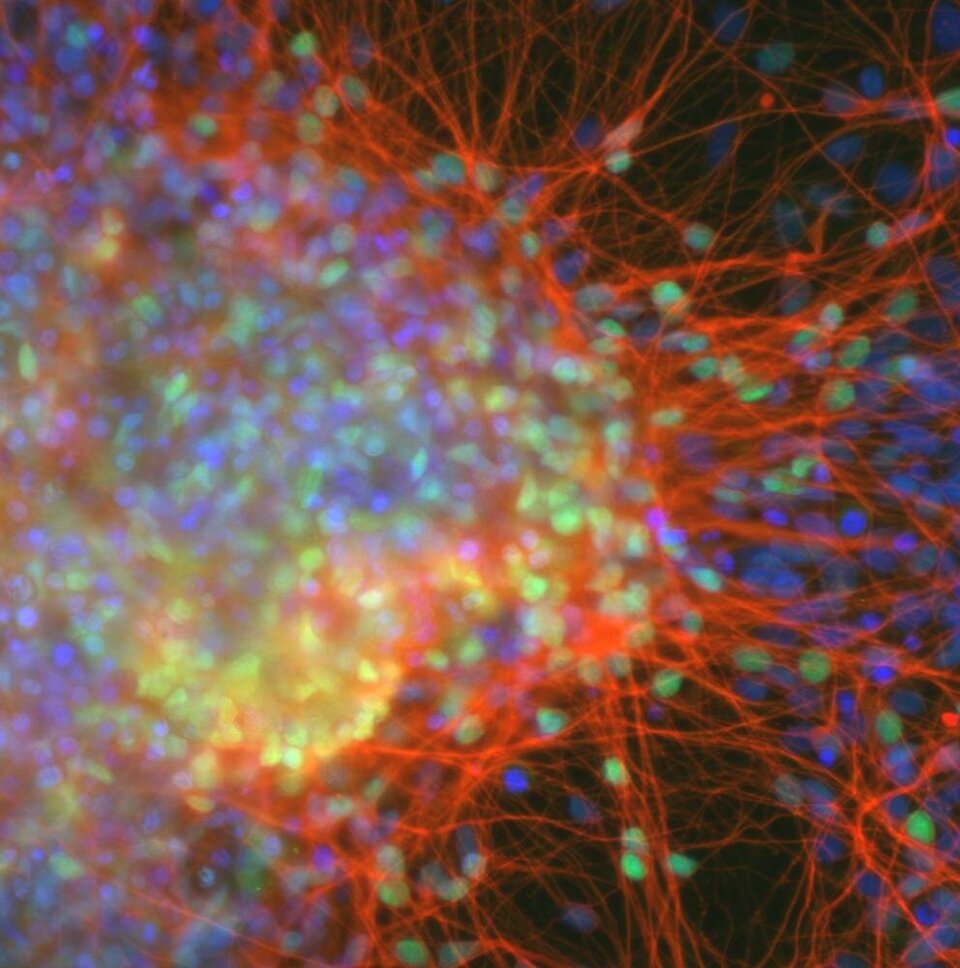 Zdjęcie przedstawia sieć neuronów. Zostały one otrzymane z indukowanych pluripotencjalnych komórek macierzystych. Na zdjęciu sieć jest utkana z cienkich czerwonych połączonych ze sobą nitek. Nitki odchodzą od punktów świetlnych w kolorach niebieskim i zielonym. W ludzkim organizmie komórki nerwowe są podstawową jednostką budującą układ nerwowy.