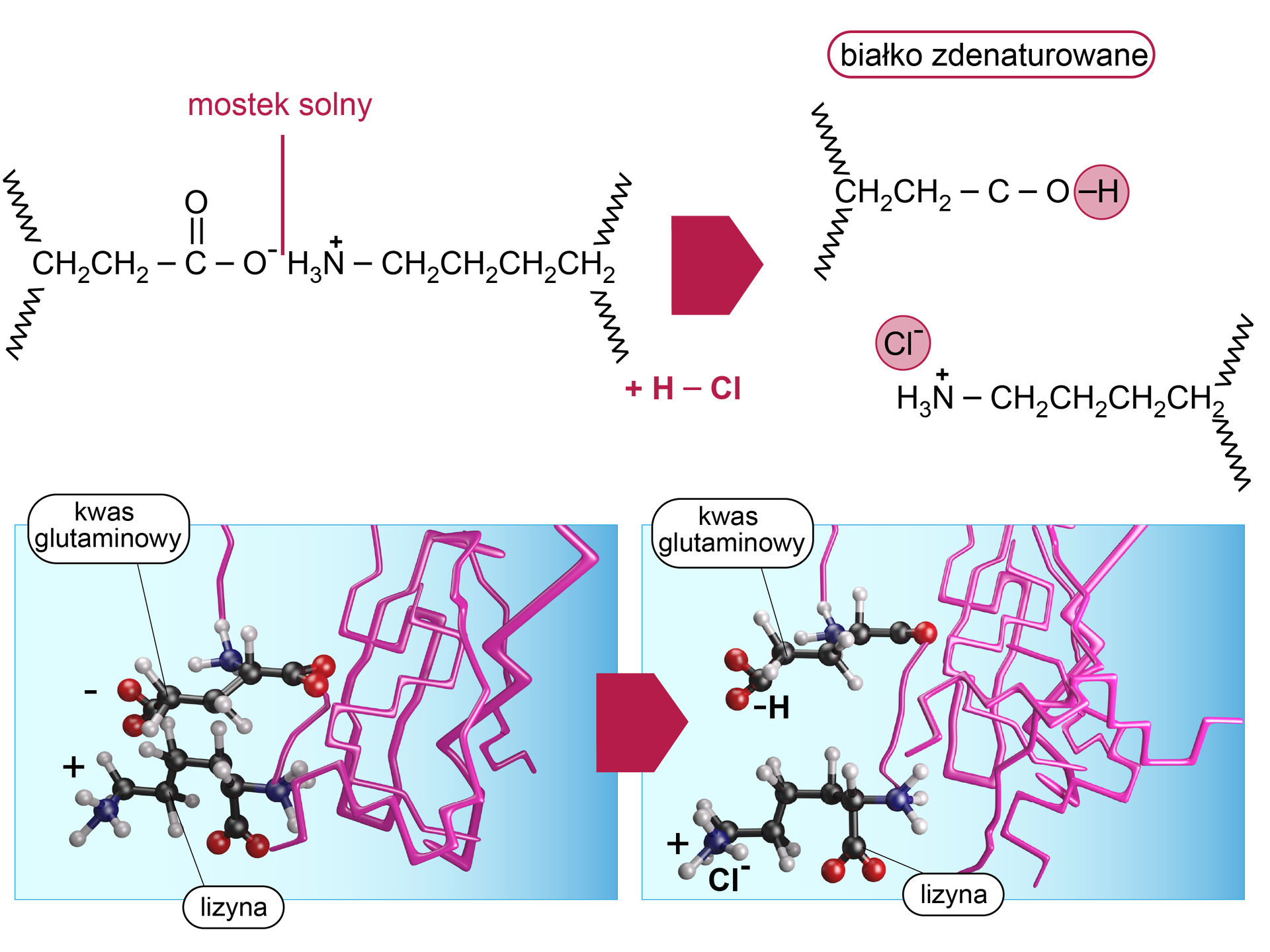 Na ilustracji zobrazowano zniszczenie mostków solnych w strukturze białka pod wpływem kwasu solnego. Mostek solny występuje w układzie COO−H3N+>. Pod wpływem kwasu chlorowodorowego powstaje białko zdenaturowane. Obecne są dwa produkty. W jednym z nich występuje grupa karboksylowa COOH, a drugi to czwartorzędowa sól amoniowa w postaci chlorku Cl−H3N+R, gdzie R to reszta aminokwasu. Mostek solny występuje między cząsteczką kwasu glutaminowego a cząsteczką lizyny. W obecności kwasu dochodzi do rozerwania tego oddziaływania. Poniżej znajduje się grafika przedstawiająca splątany łańcuch białkowy o strukturze stabilizowanej między innymi przez mostek solny występujący pomiędzy kwasem glutaminowym wbudowanym w łańcuch a lizyną również wbudowana w tenże łańcuch. Wiązanie ulega zerwaniu, degradacja mostka prowadzi do zniszczenia struktury przestrzennej białka, a tym samym do denaturacji białka.
