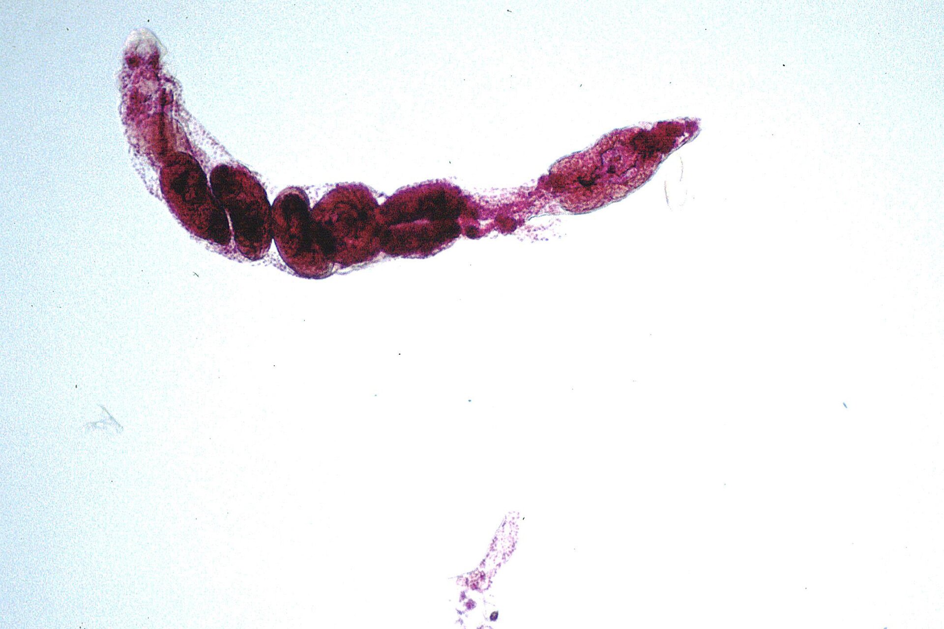 Na ilustracji przedstawione są larwy motylicy wątrobowej. Mają podłużny kształt z przewężeniami, kolor ciemnoróżowy.