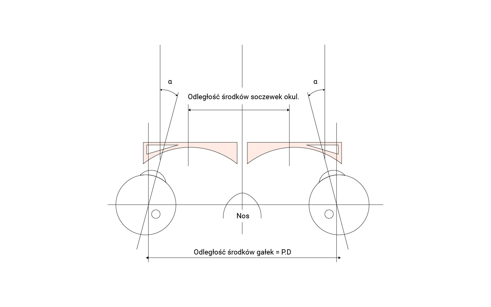 Grafika przedstawia wymuszenie zeza zbieżnego przez okulary z soczewkami ujemnymi o za małym rozstawieniu soczewek.