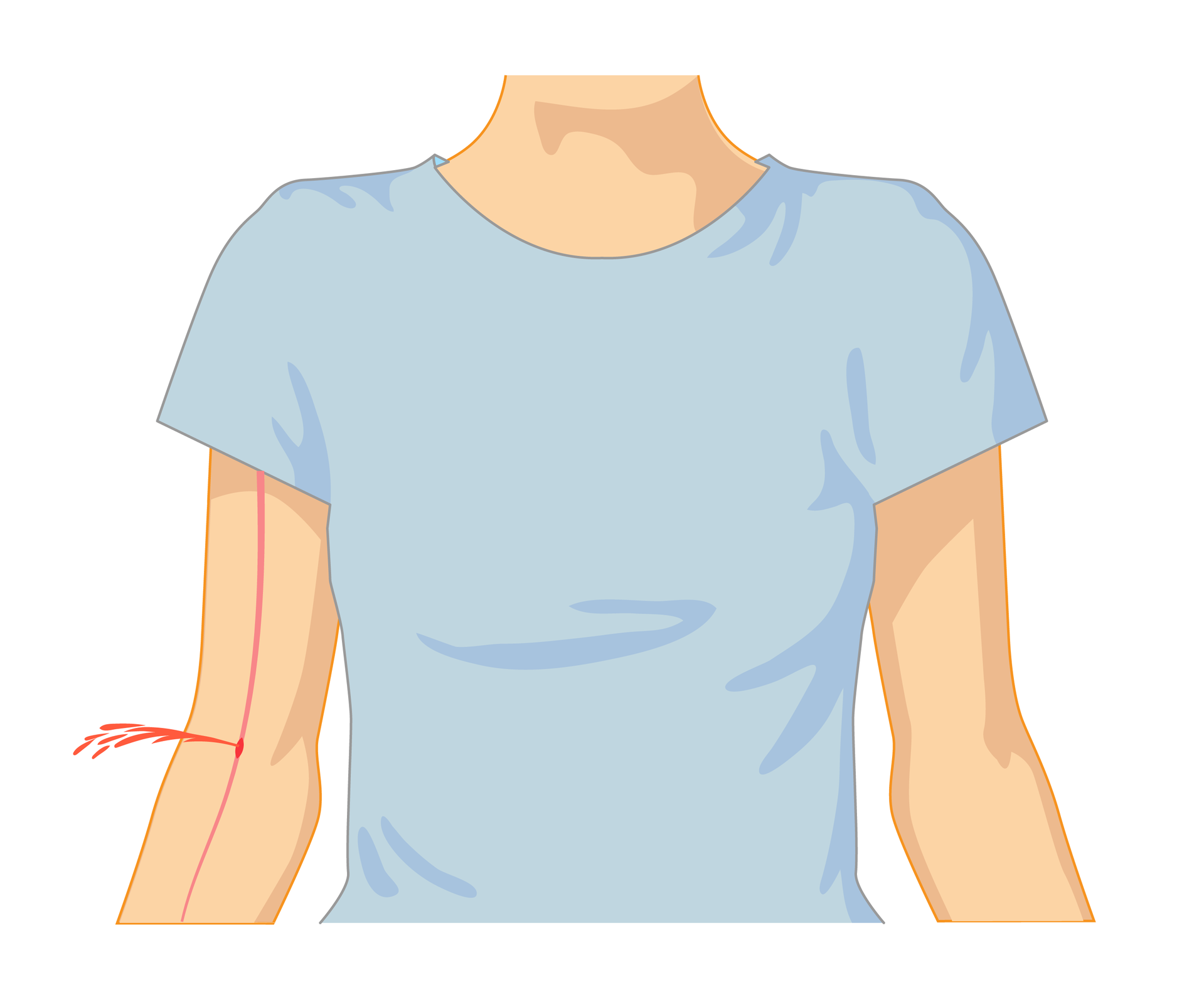 Ilustracja przedstawiająca cechy charakterystyczne krwotoków żylnych i tętniczych. Osoba od szyi do pasa ubrana w t‑shirt stojąca przodem do obserwatora. Na ilustracji numer dwa krwotok tętniczy. Na ręce po lewej stronie jasnoczerwona pionowa linia przedstawiająca tętnicę. W zgięciu ręki pod łokciem krew tryska na zewnątrz silnym strumieniem w bok.