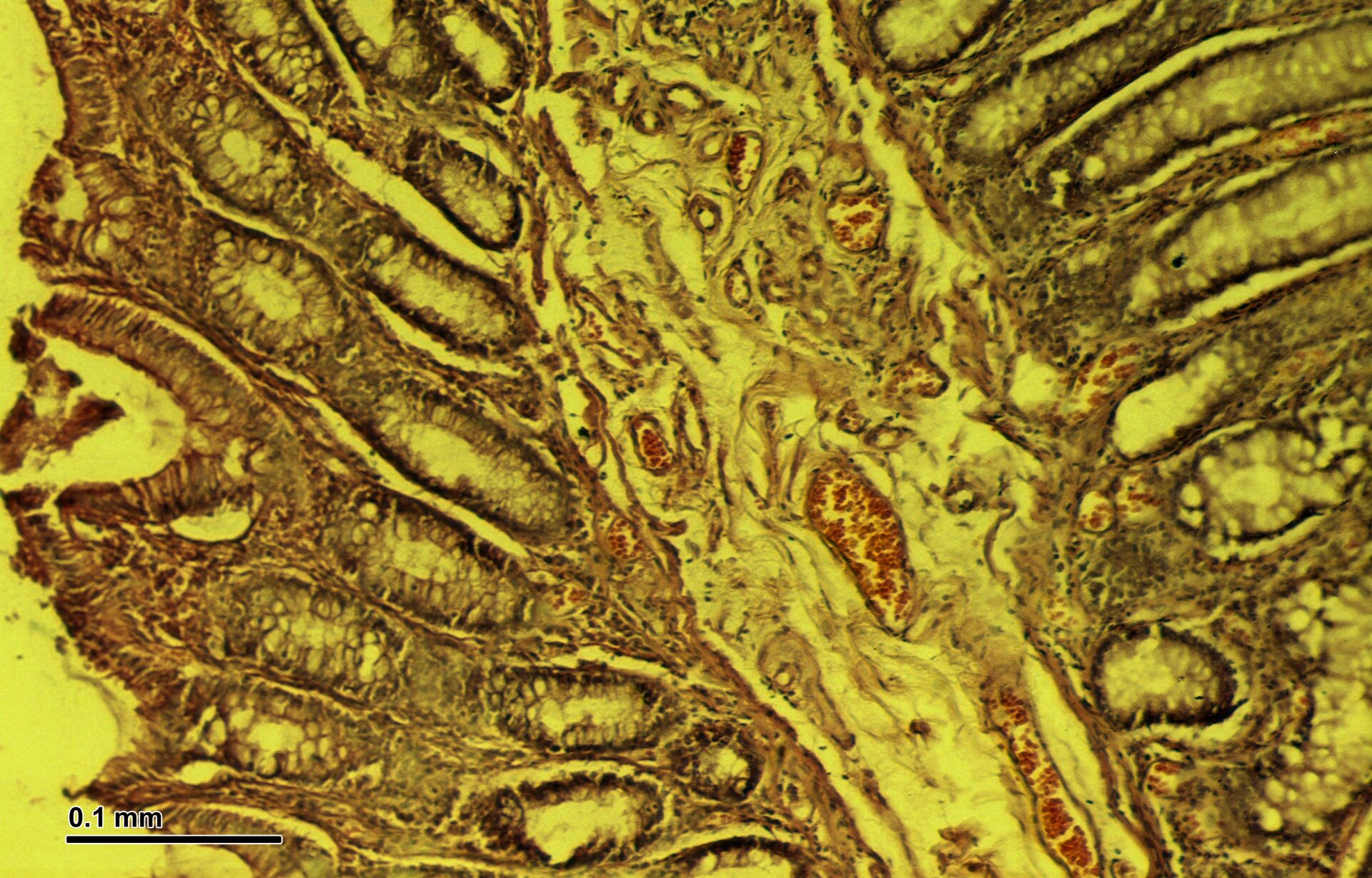 Zdjęcie mikroskopowe przedstawia jelito grube. Widoczne są cztery warstwy. 1. Błona śluzowa. 2. Błona podśluzowa z gruczołami, naczyniami krwionośnymi i limfatycznymi. 3. Błona mięśniowa. 4. Błona surowicza.