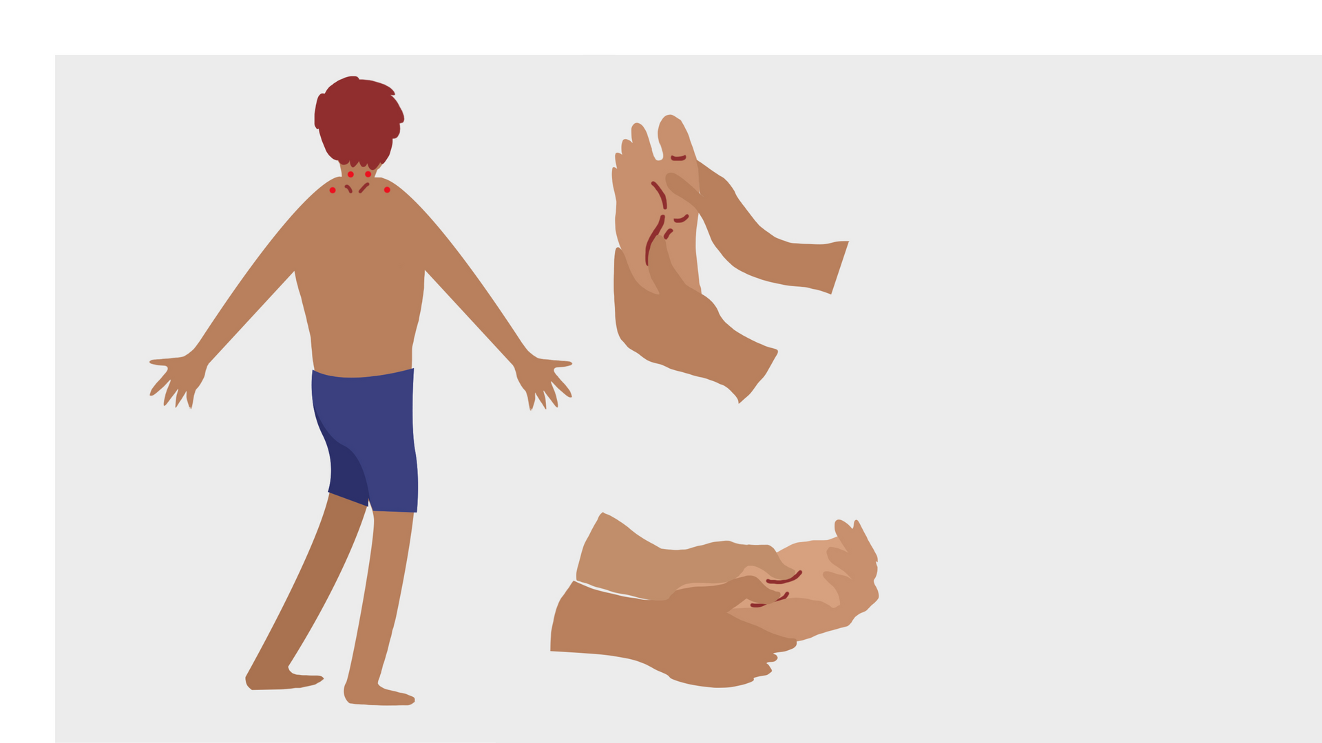 Ilustracja przedstawia sylwetkę, na której zaznaczone są punkty uaktywniane podczas akupunktury. Obok znajdują się ryszunki dłoni i stóp, na których również zaznaczono takie punkty.