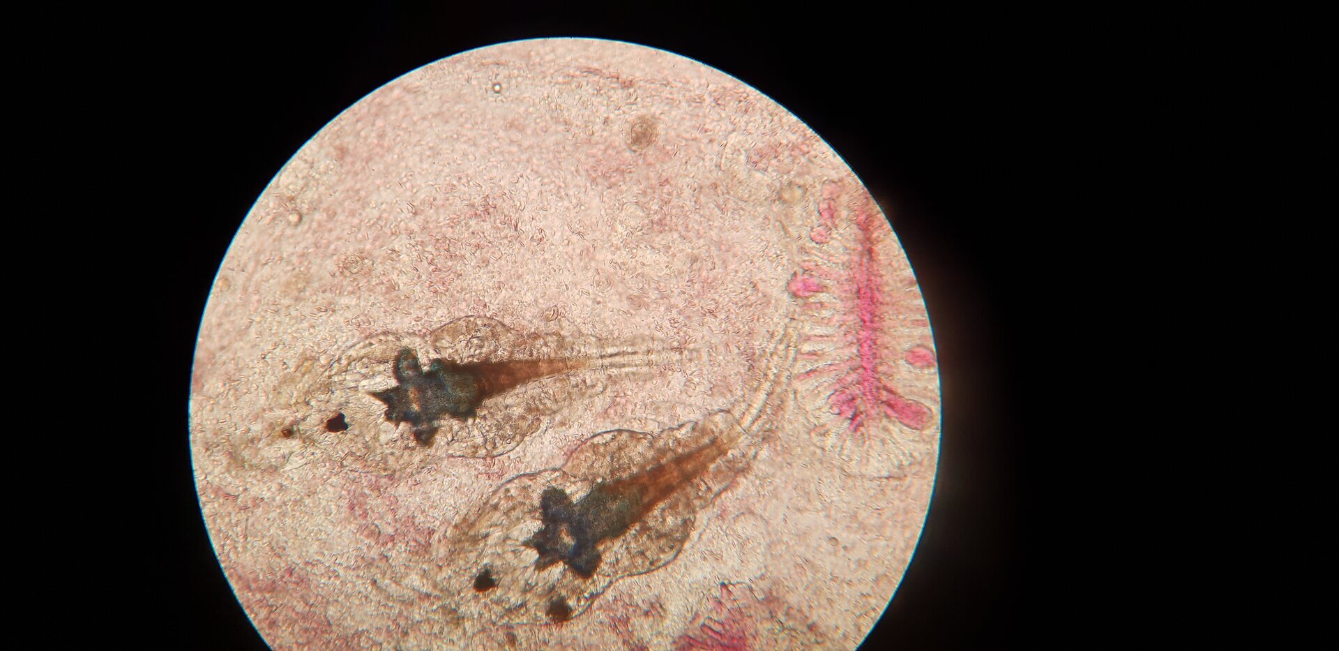 Zdjęcie przedstawia widziane pod mikroskopem widłonogi z rodzaju Ergasilus. Mają one beczułkowaty kształt zwężający się ku końcowi ciała. Ciało jest przezroczyste. Ciemny jest tylko widoczny w środku ciała układ pokarmowy.