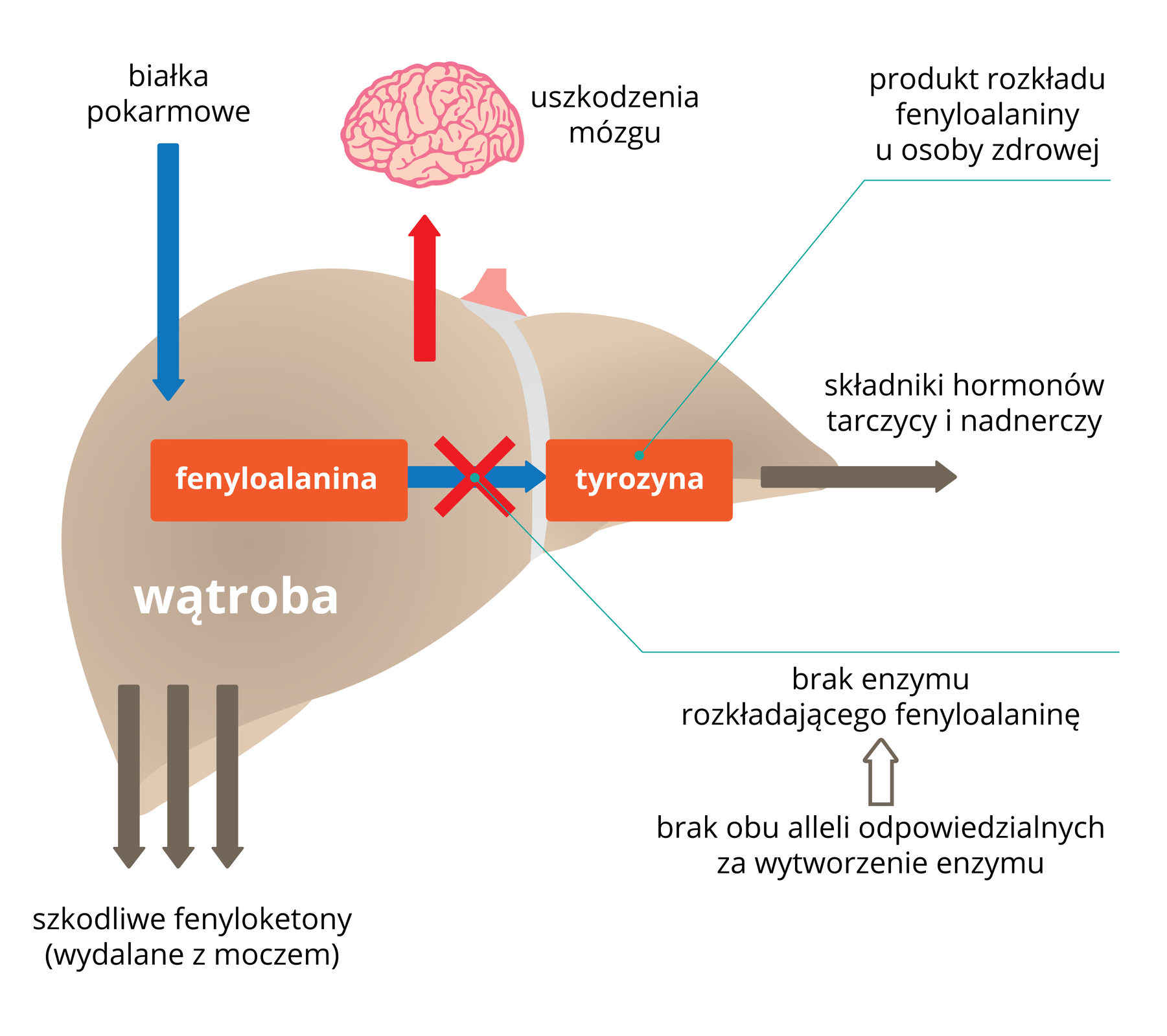 Ilustracja przedstawia wątrobę i szlak przemiany fenyloalaniny w wątrobie. Fenyloalanina jest dostarczana do organizmu człowieka wraz z białkami pokarmowymi. Brak obu alleli odpowiedzialnych za wytworzenie enzymu prowadzi do braku enzymu rozkładającego fenyloalaninę. Brak enzymów przekształcających fenyloalaninę do tyrozyny, będącej prekursorem hormonów tarczycy i nadnerczy, prowadzi do nagromadzenia fenyloalaniny w organizmie i uszkodzenia mózgu. Szkodliwe fenyloketony wydalane są z moczem.