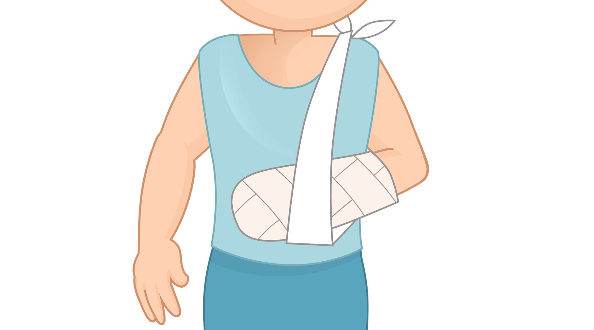 Na ilustracji znajduje się ręka w gipsie.