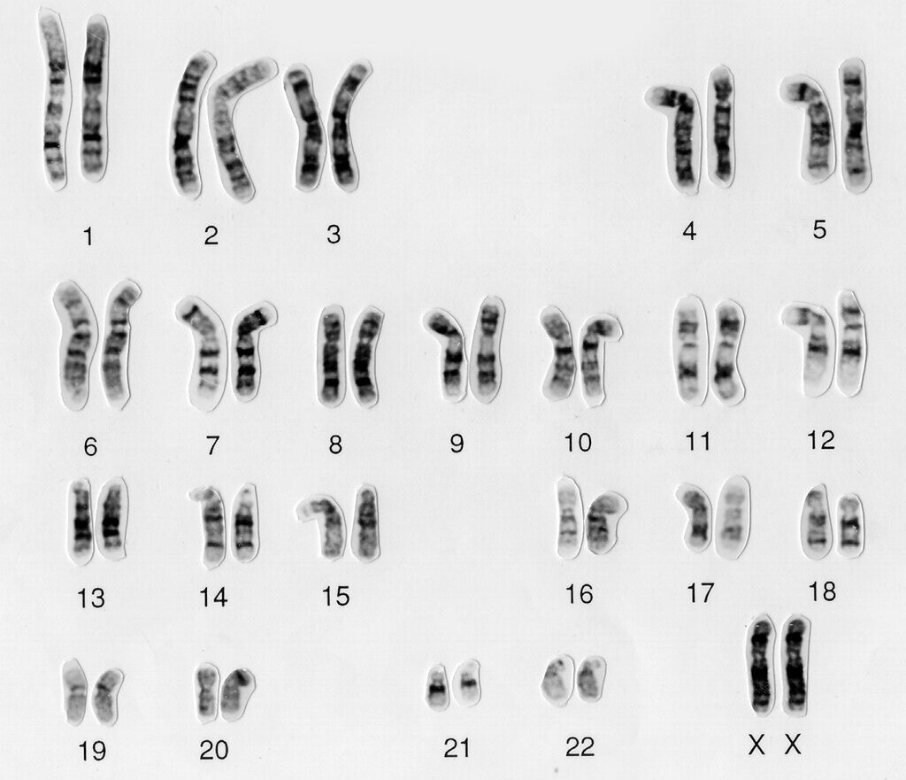 Ilustracja interaktywna przedstawia kariotyp kobiety. Na ilustracji są 22 pary chromosomów, ostatnia para jest oznaczona dużymi literami XX. Początkowo chromosomy są większe, następnie mniejsze. Para XX jest średniej wielkości. W chromosomach widoczne są paski w różnych odcieniach szarości. Chromatydy w danej parze chromosomów mają stosunkowo równą długość.