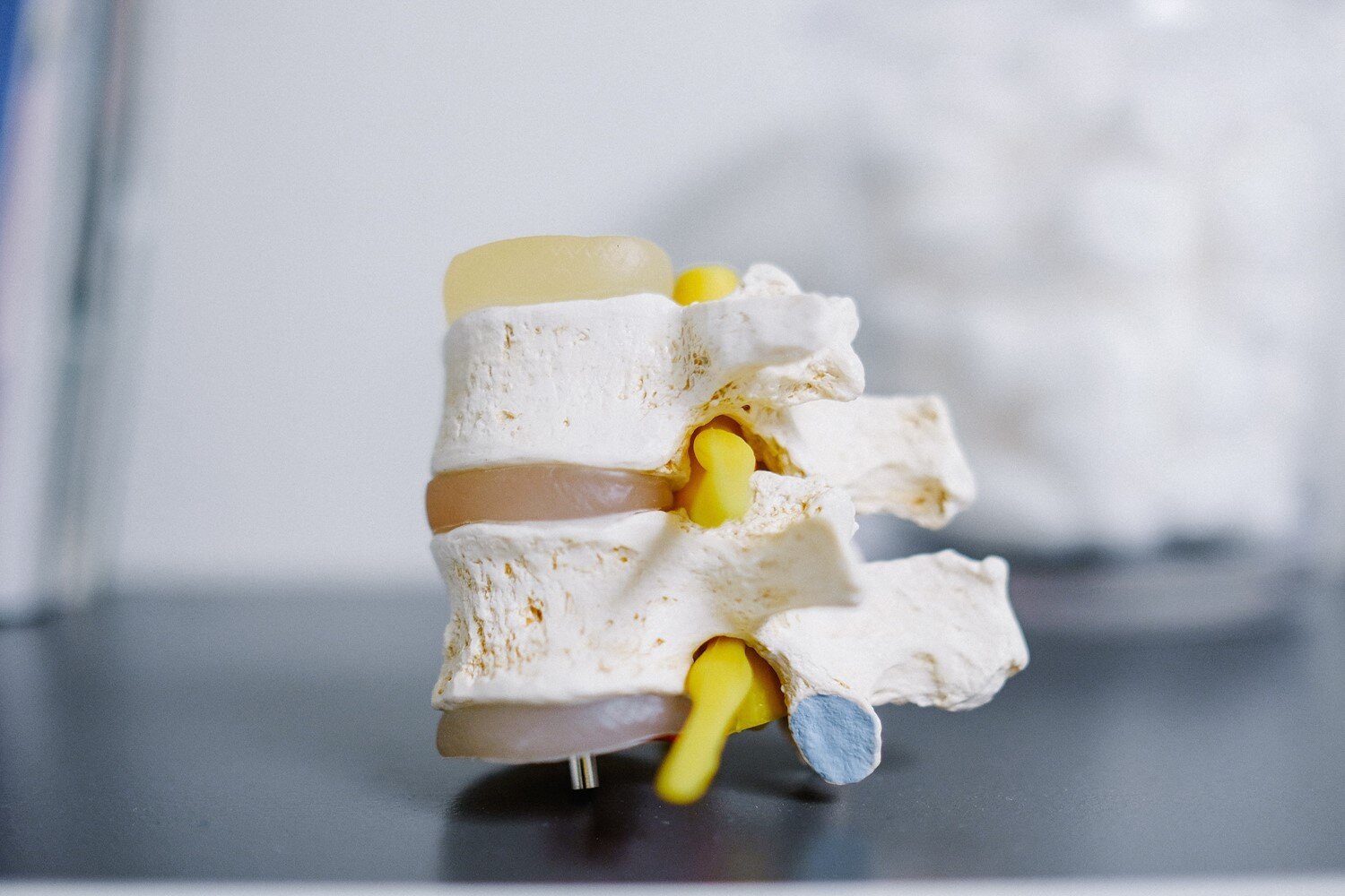 Zdjęcie przedstawia model fragmentu kręgosłupa, składający się z dwóch kręgów. Nad i pod każdym kręgiem jest maź stawowa.