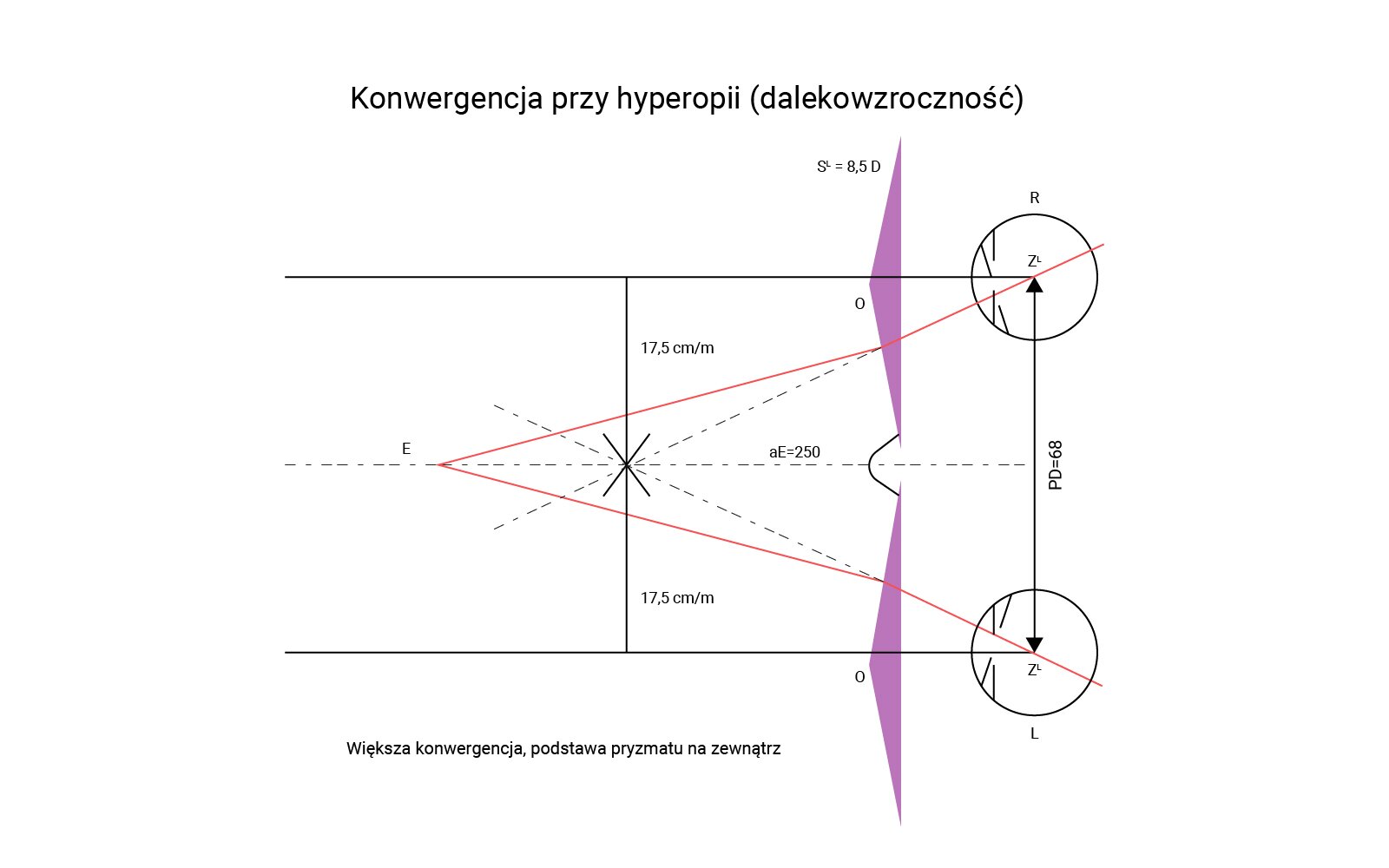 Na grafice przedstawiona konwergencja przy hyperopii (dalekowzroczność).